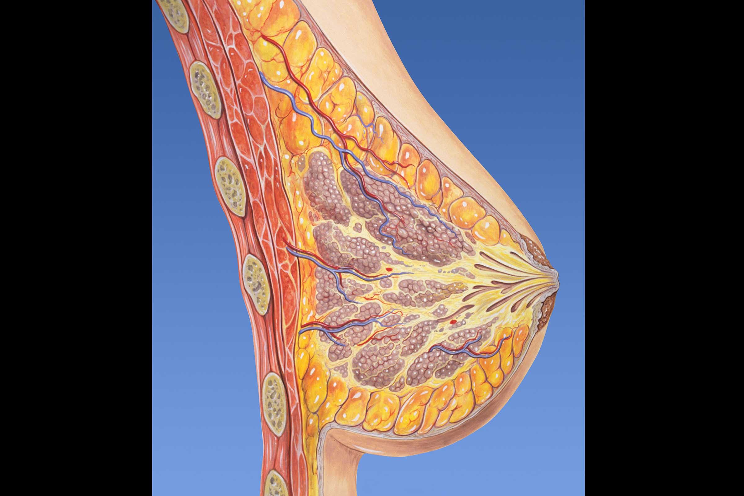 Ilustração da mama feminina. Especialista baiano defende tese premiada sobre lesões mamárias. Estudo teve apoio científico da Clínica CAM e foi publicado em veículo internacional.