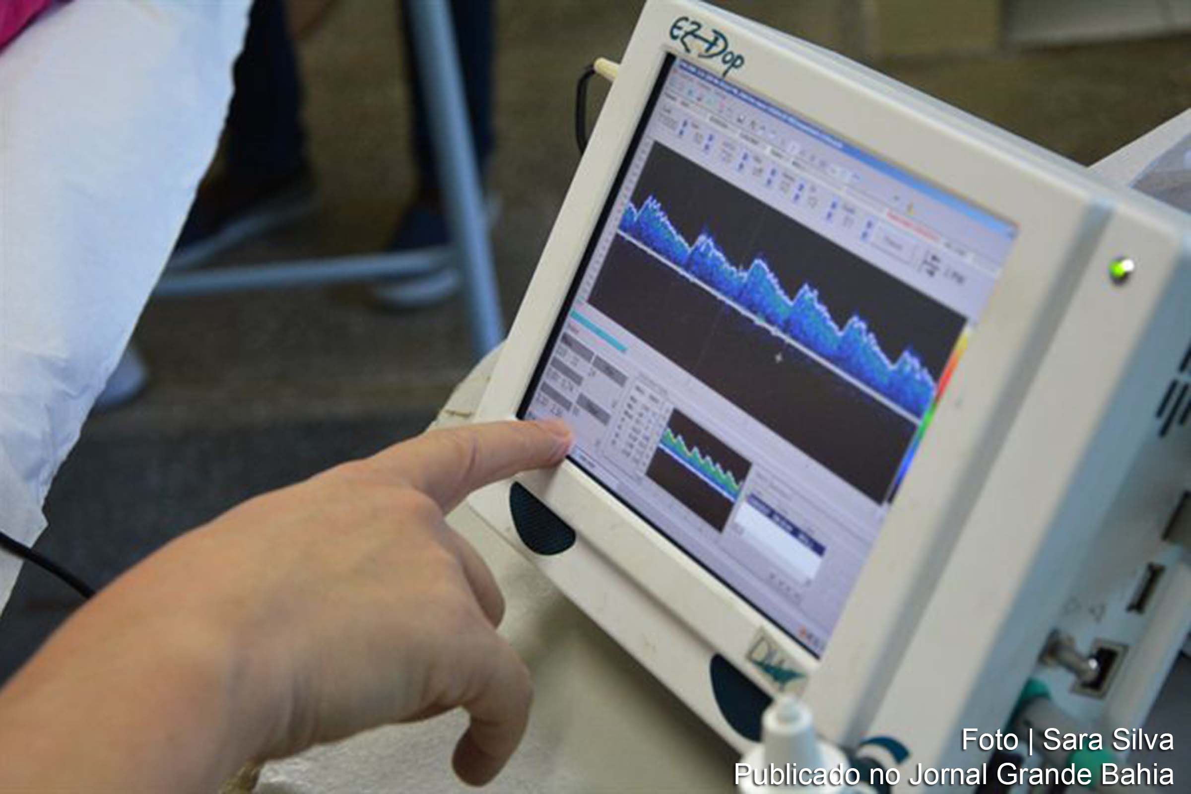 Exame de doppler transcraniano é oferecido para pacientes com anemia falciforme em Feira de Santana.