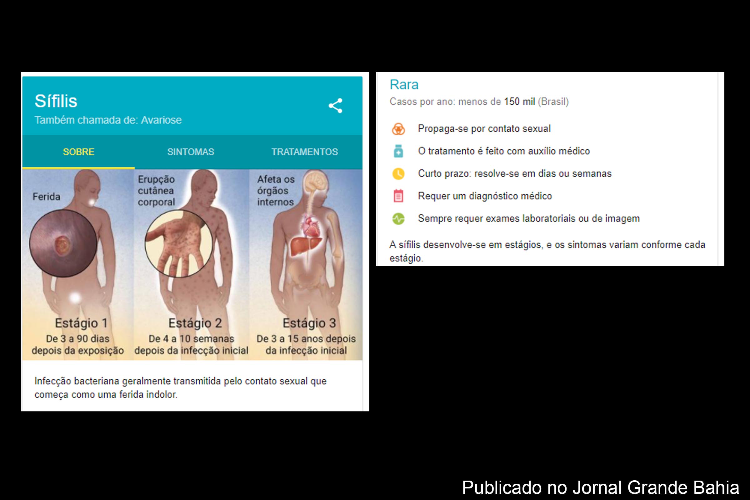 Infográfico sobre sífilis.