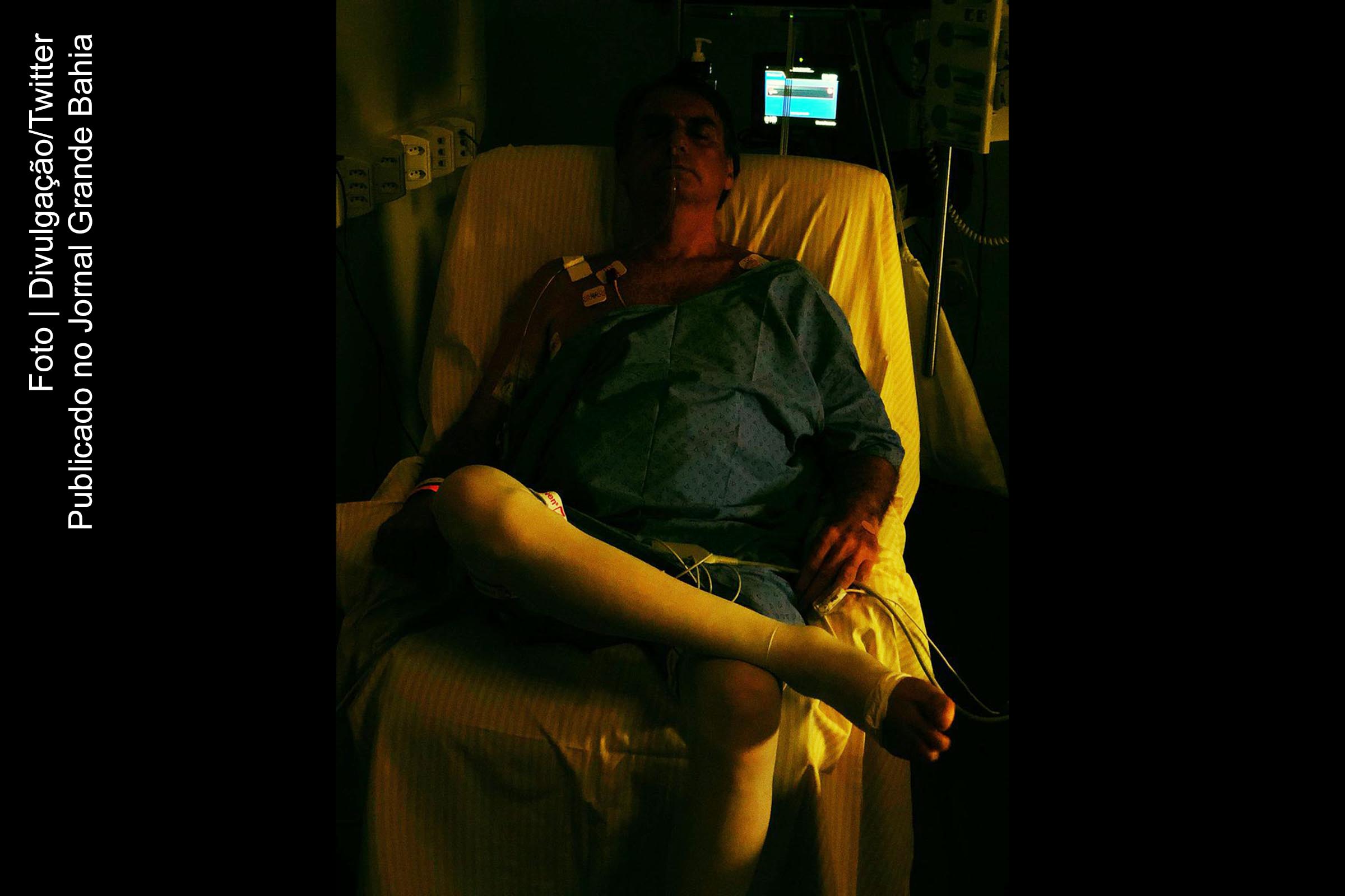 Candidato à presidência da República Jair Bolsonaro (PSL) no Hospital Albert Einstein.