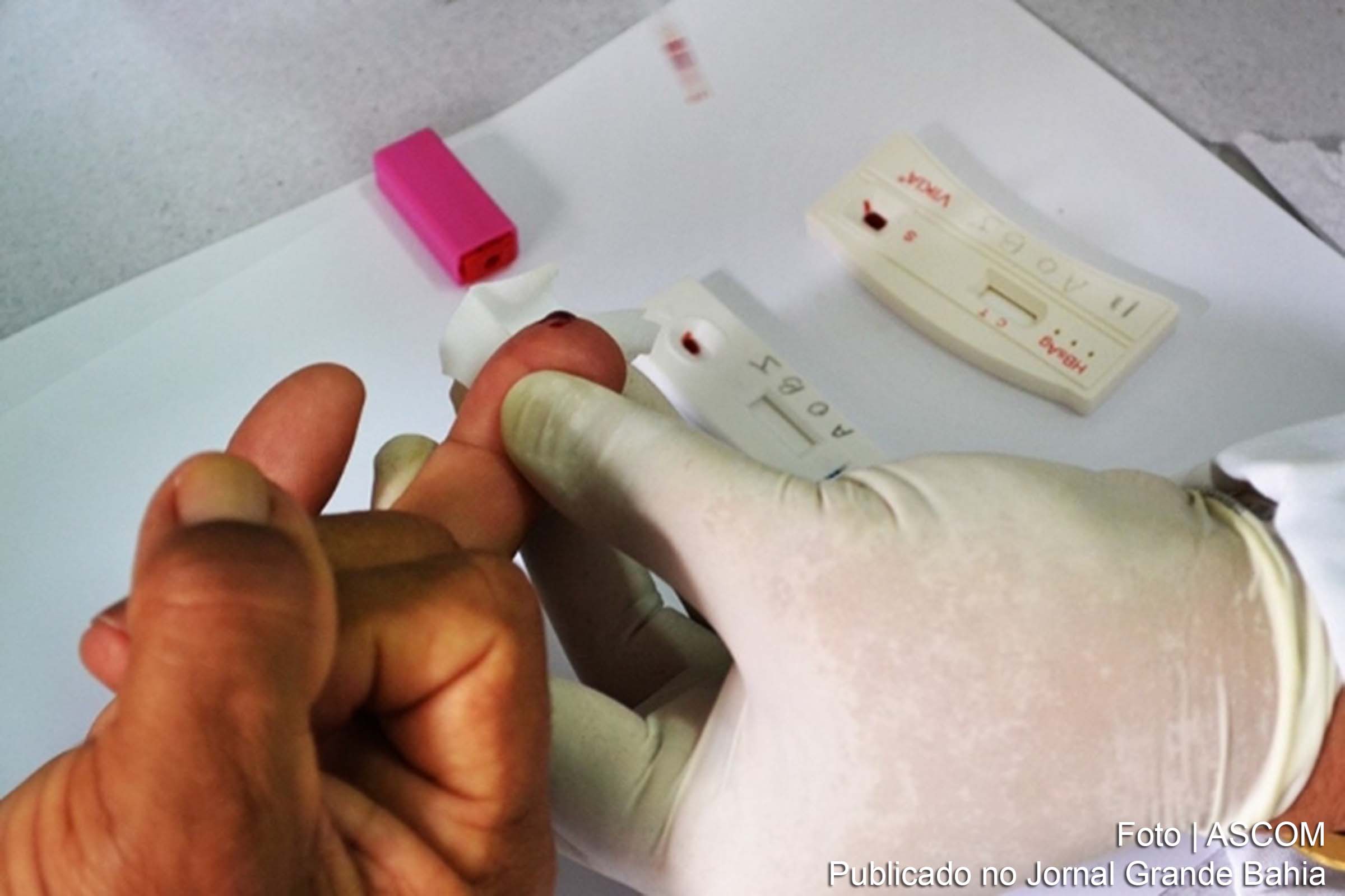 Testes rápidos de sífilis e HIV.