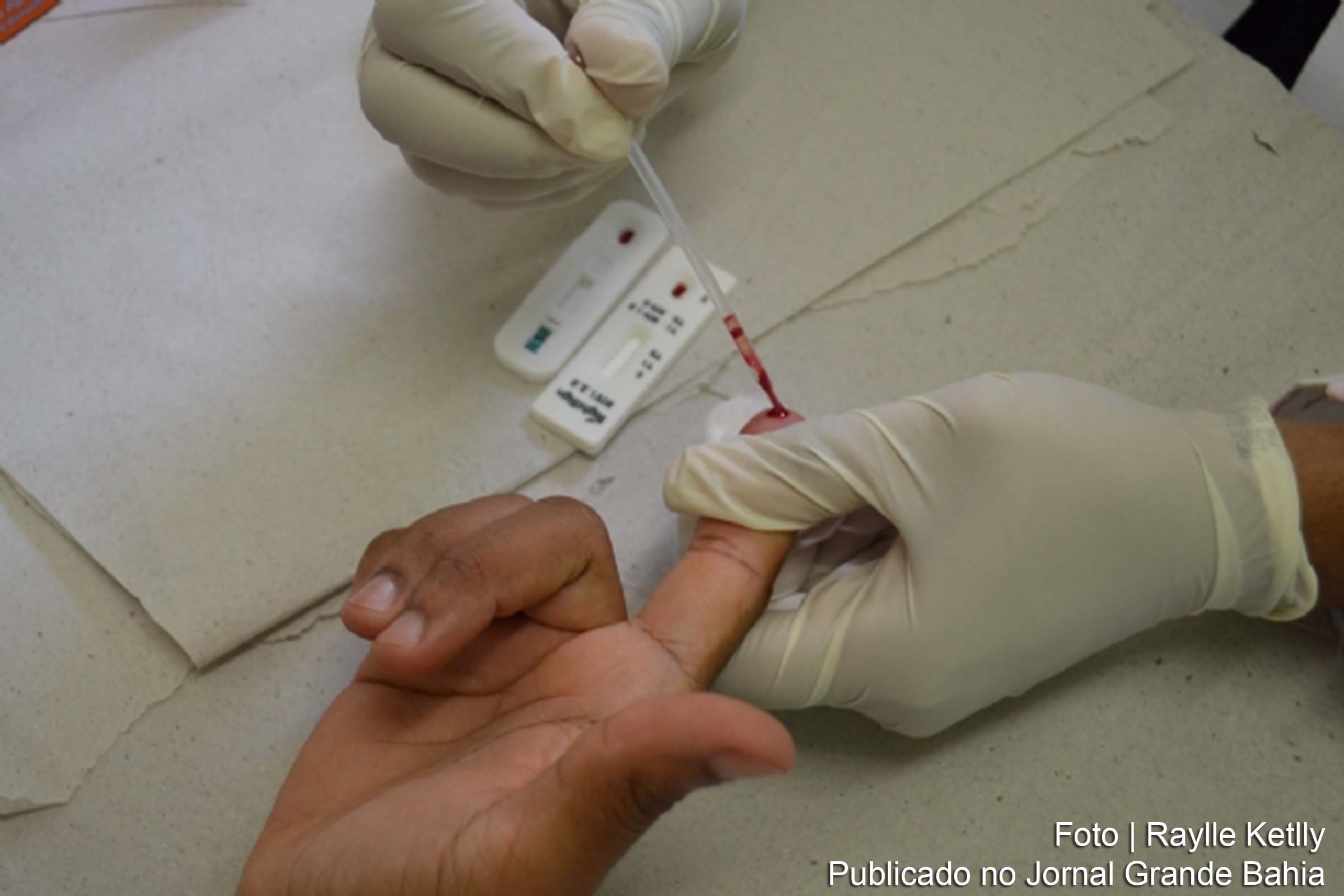 Teste rápido para diagnóstico do HIV.