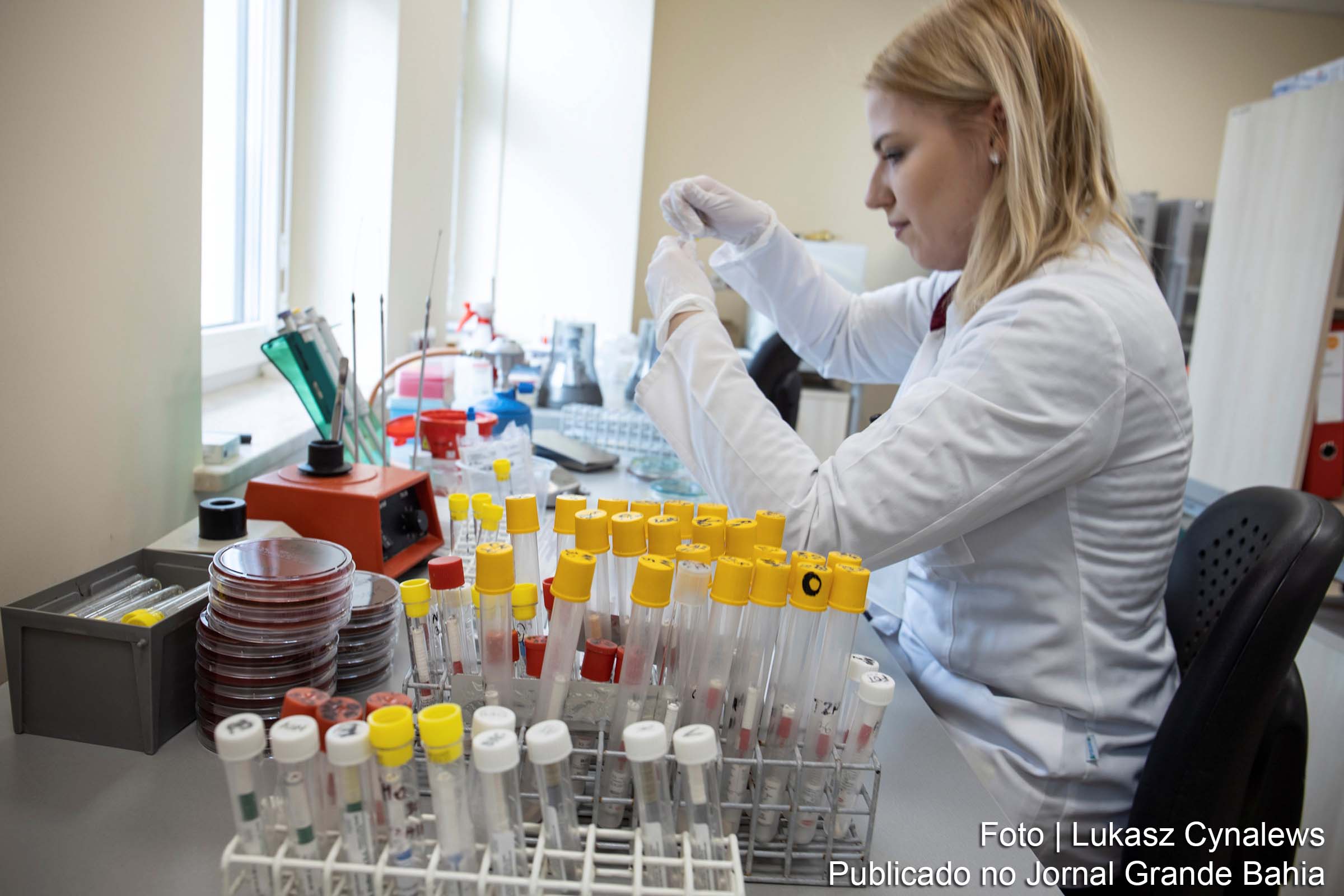 Chegam ao Brasil 500 mil testes para diagnóstico da covid-19.