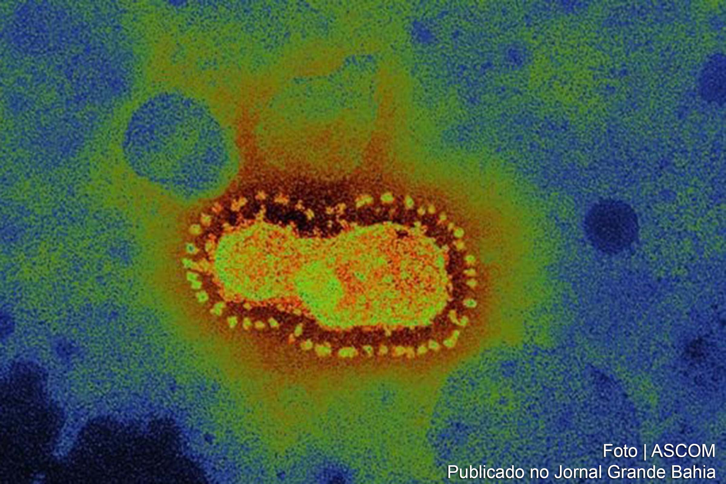 Coronavírus pode estar causando formação anormal de coágulos em pacientes.