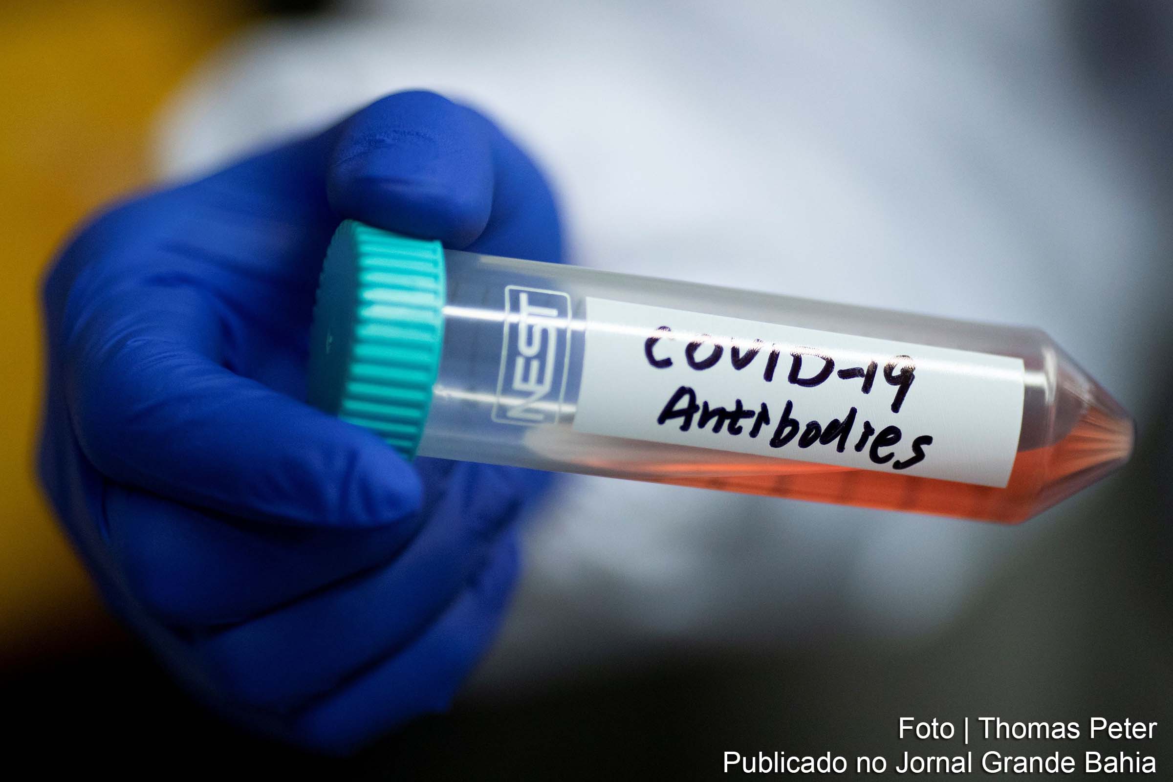 Pesquisadores tentam encontrar fármacos que debele a infeção por Covid-19.