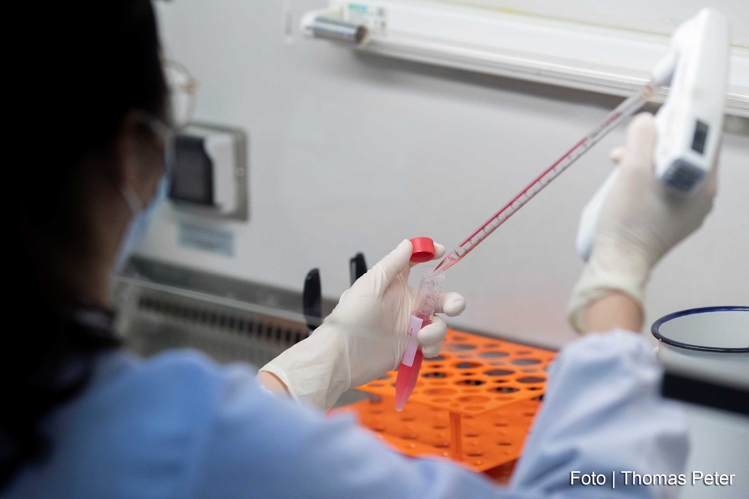 Pesquisas sobre formas de evitar a contaminação por Covid-19 avançam.