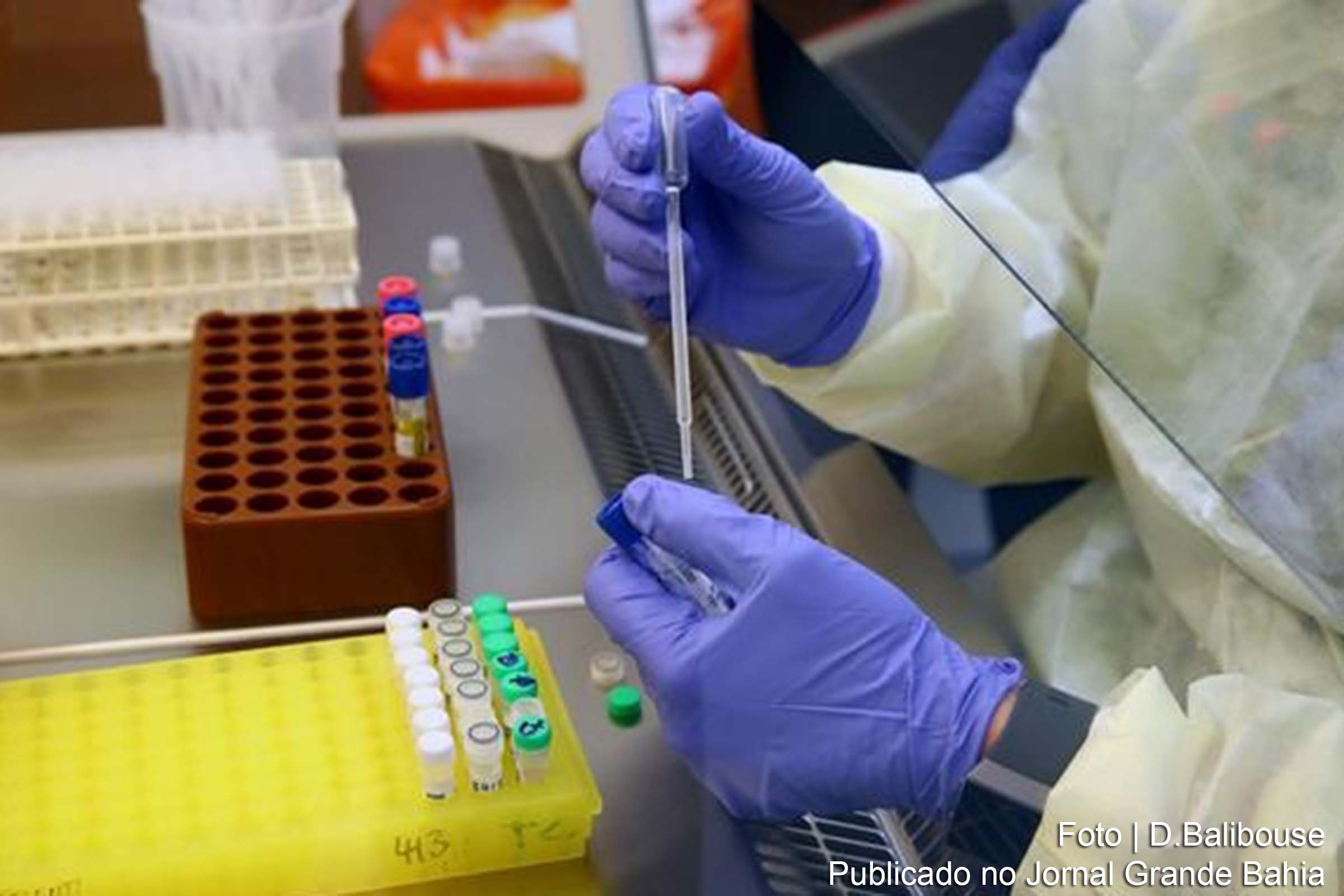Resultados com atazanavir foram melhores do que os observados com a cloroquina.