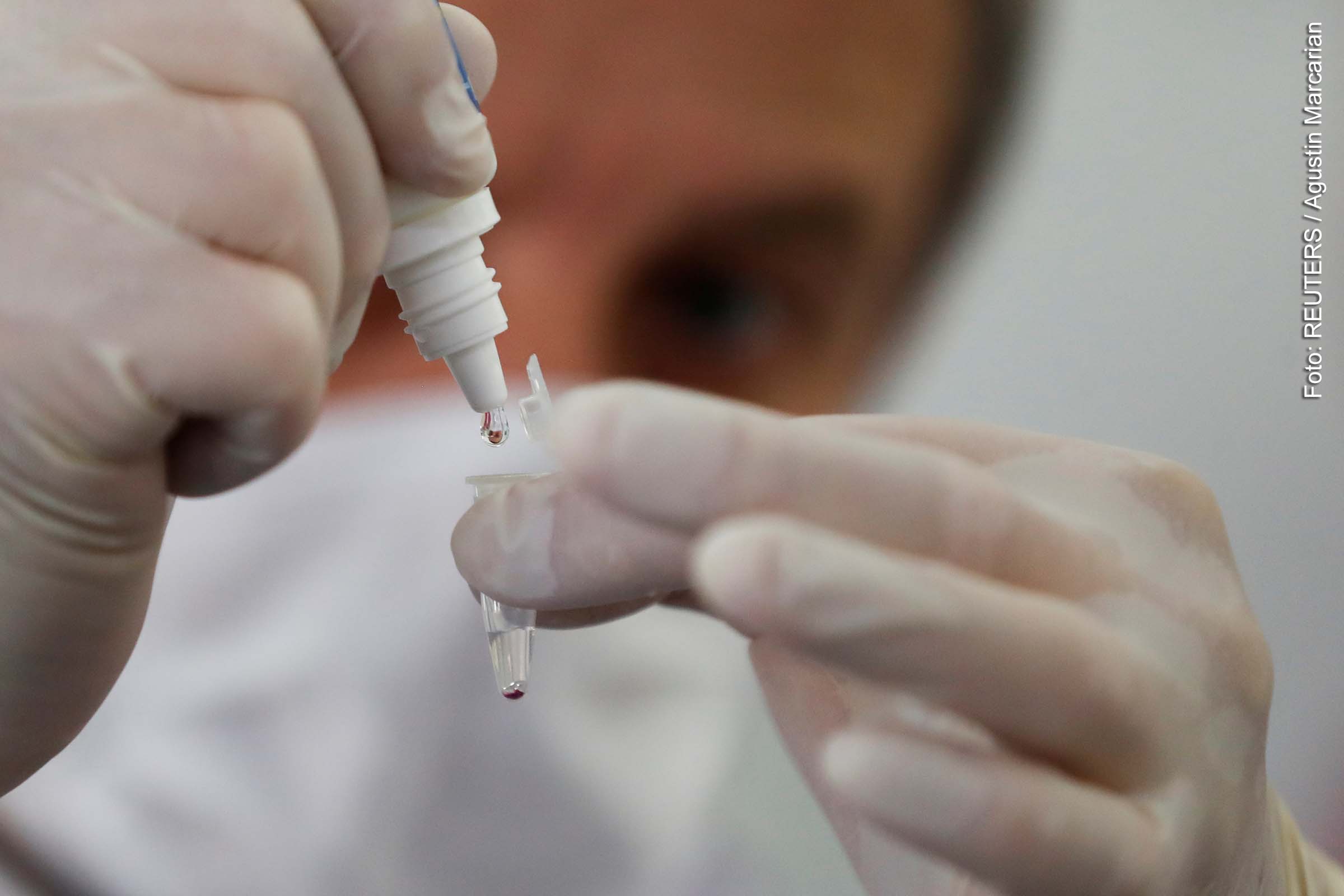 Laboratório Central da Bahia (LACEN) realiza testes e informa sobre a ocorrência de 32 novos casos da Covid-19 em Feira de Santana.