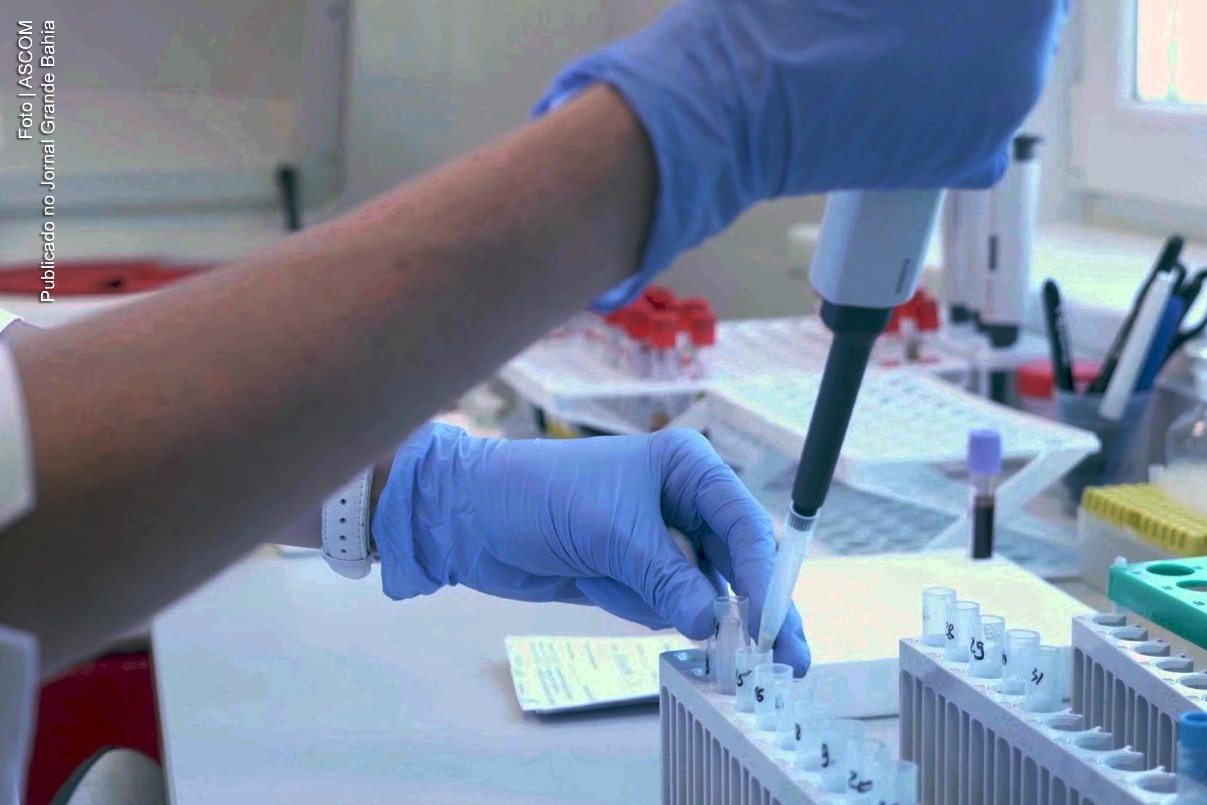 Laboratório Central da Bahia (LACEN) realiza testes e informa sobre a ocorrência de novos casos da Covid-19 em Feira de Santana.