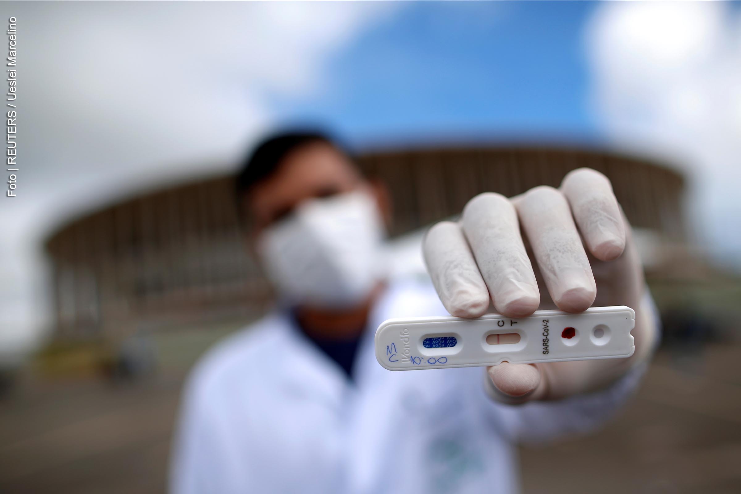 Governos estaduais e prefeituras realizam menos de 10% de testes de Covid-19 entregues ao Ministério da Saúde