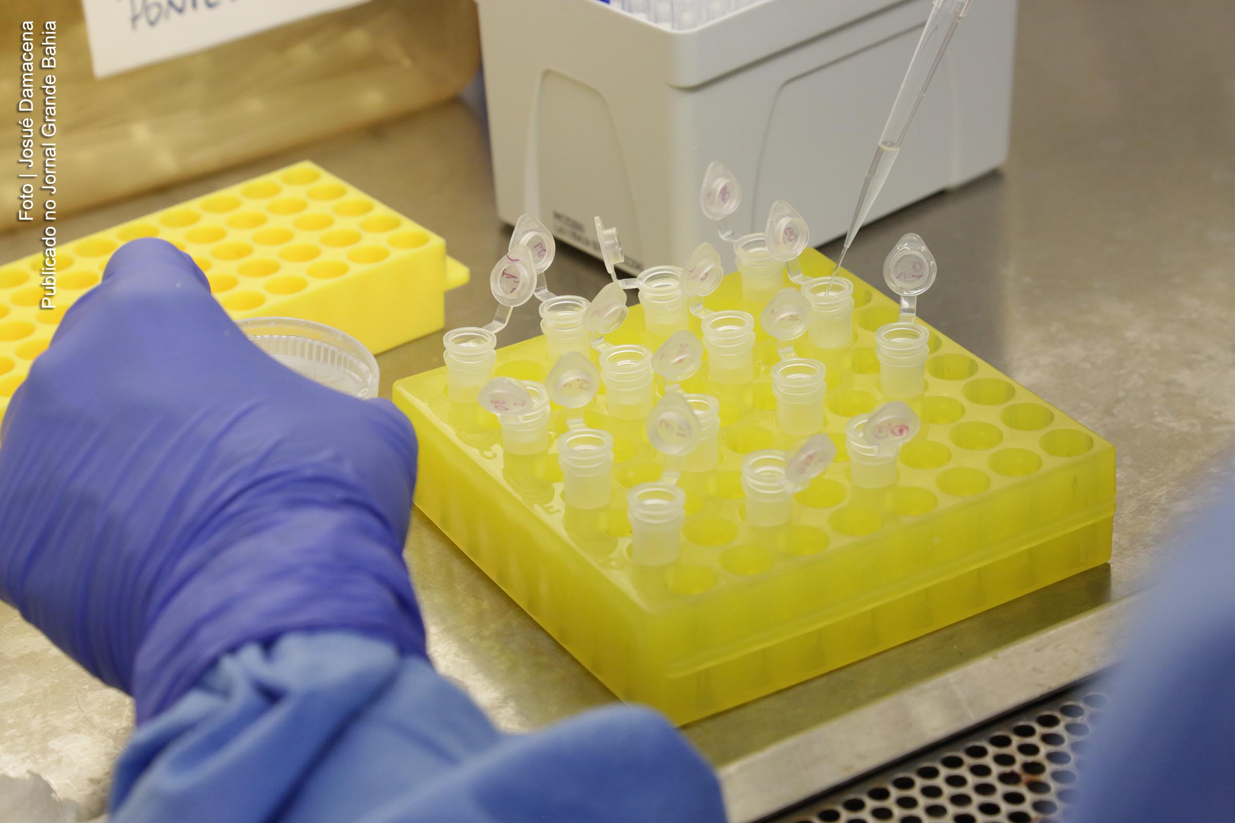 Testes laboratoriais avaliam infecção por SARS-CoV-2, vírus causador da Covid-19.