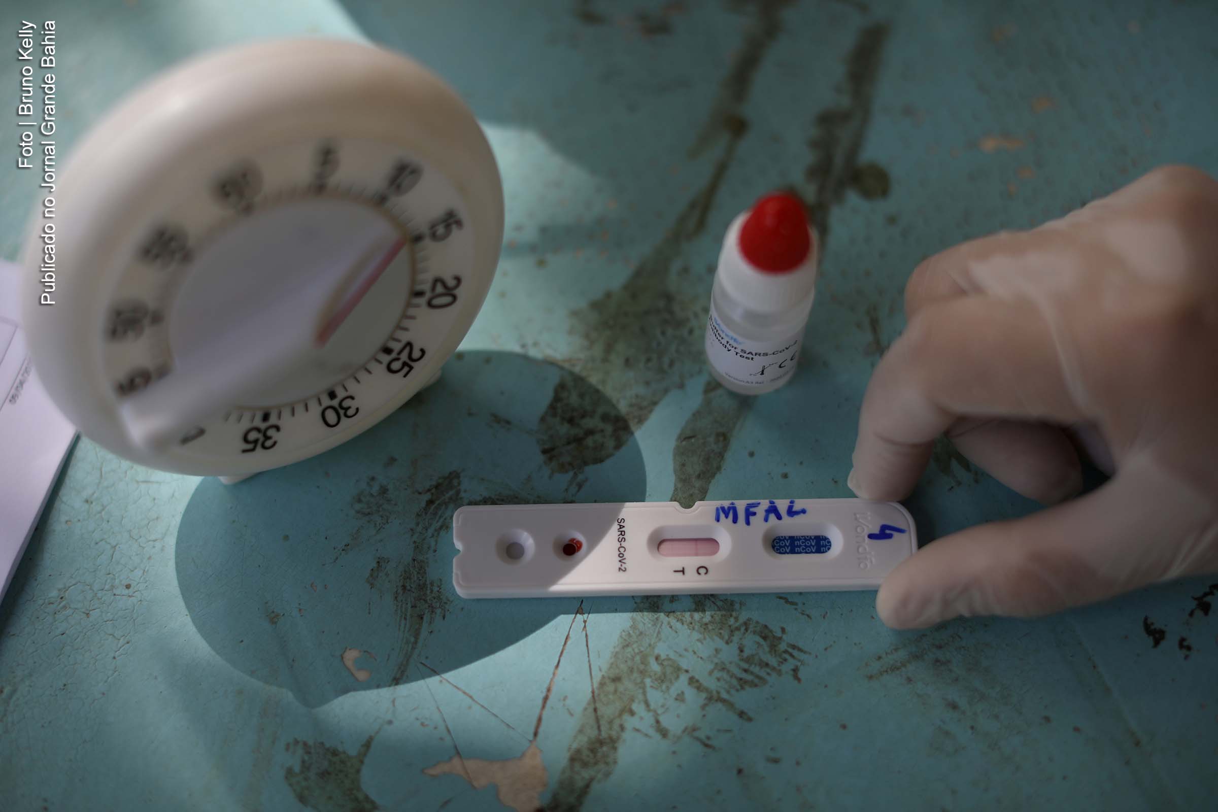 Dados sobre casos da Covid-19 em São Gonçalo dos Campos apresentam inconsistência.