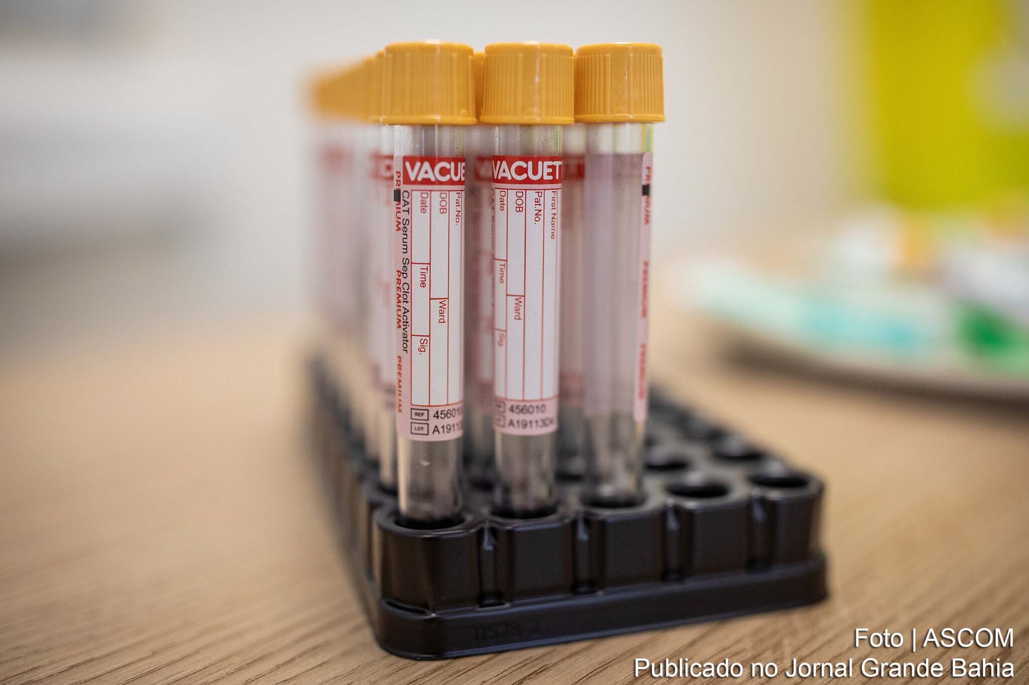 Governo Federal registra casos da Covid-19 no Brasil.