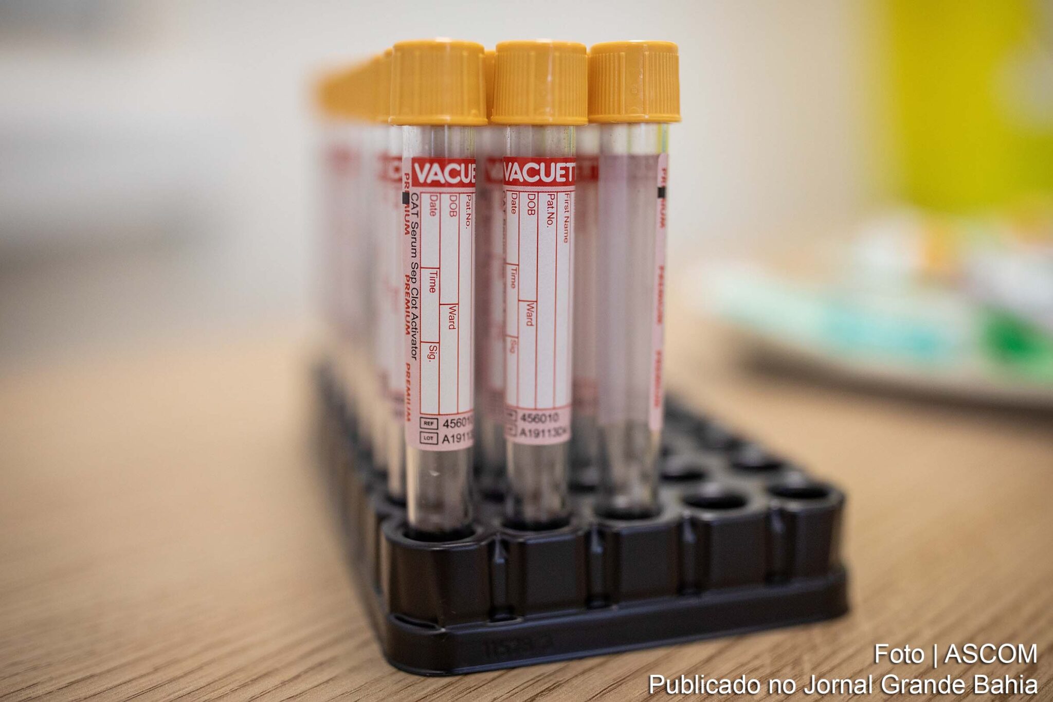 Covid-19: Brasil acumula 4,4 milhões de casos e 134,9 mil mortes.