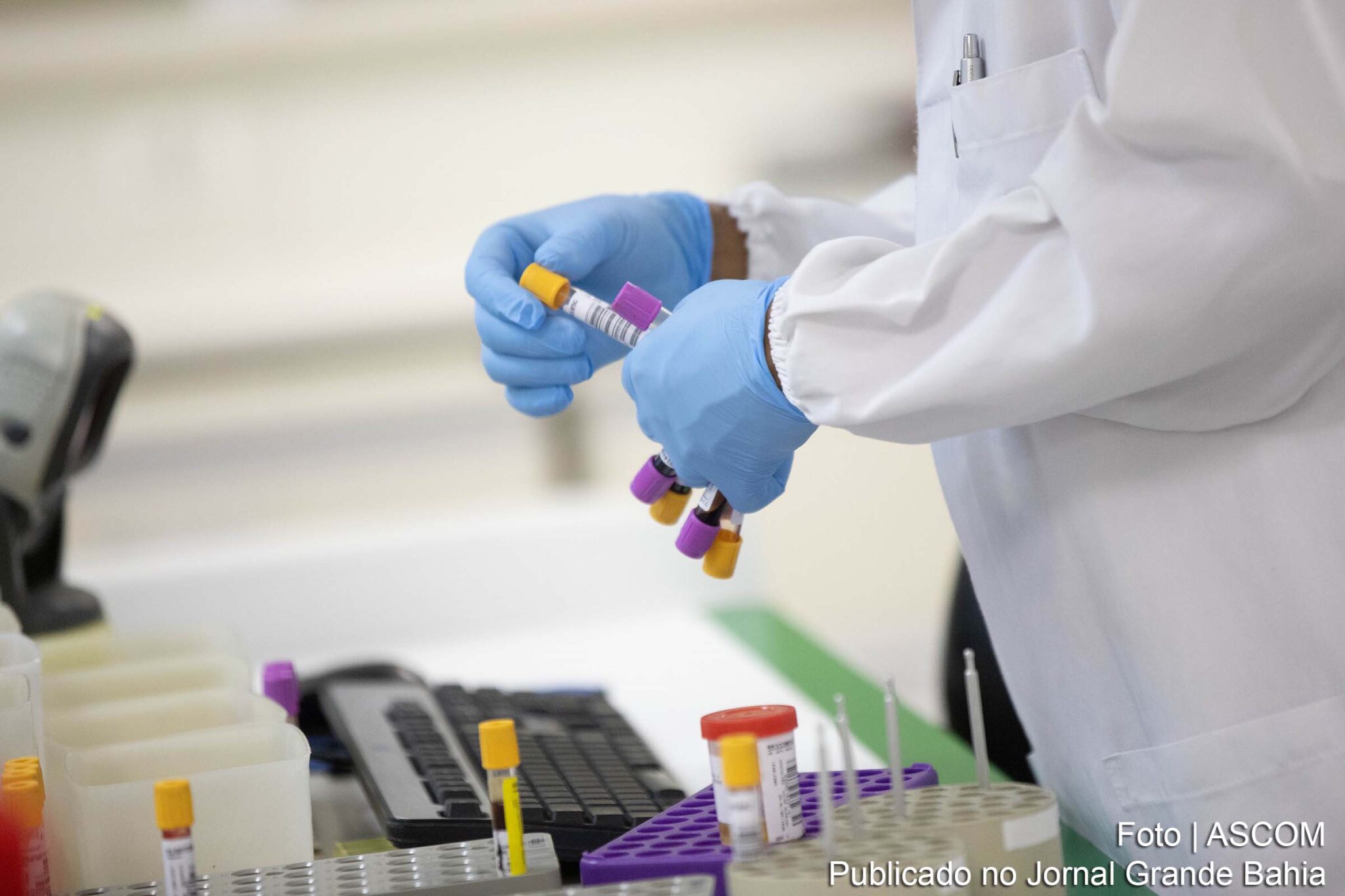 Em uma semana, casos da Covid-19 caem 30% e mortes, 13%