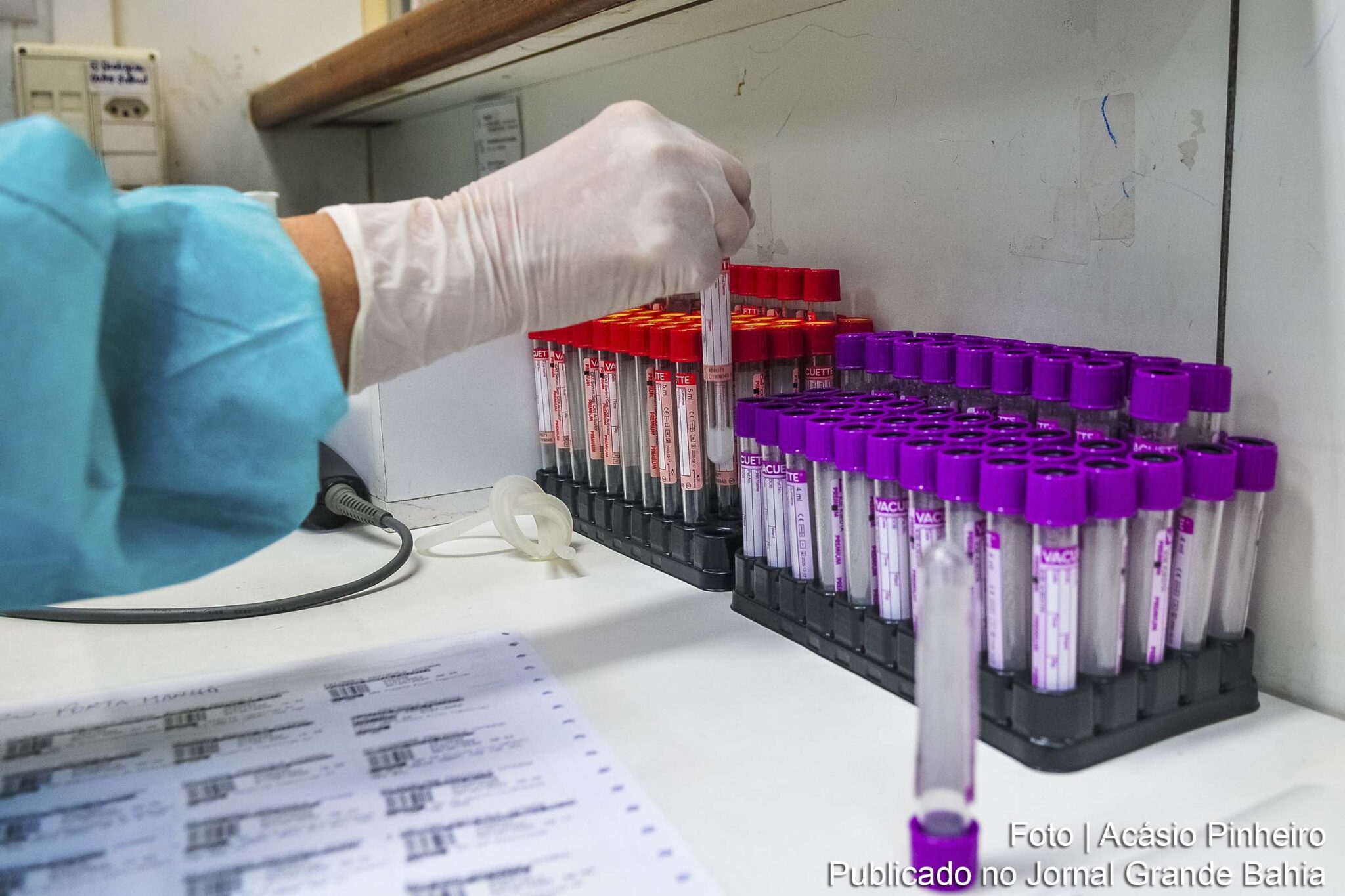 Estudos sobre a Covid-19 revelam novos aspectos da doença e possíveis tratamento dos infectados.