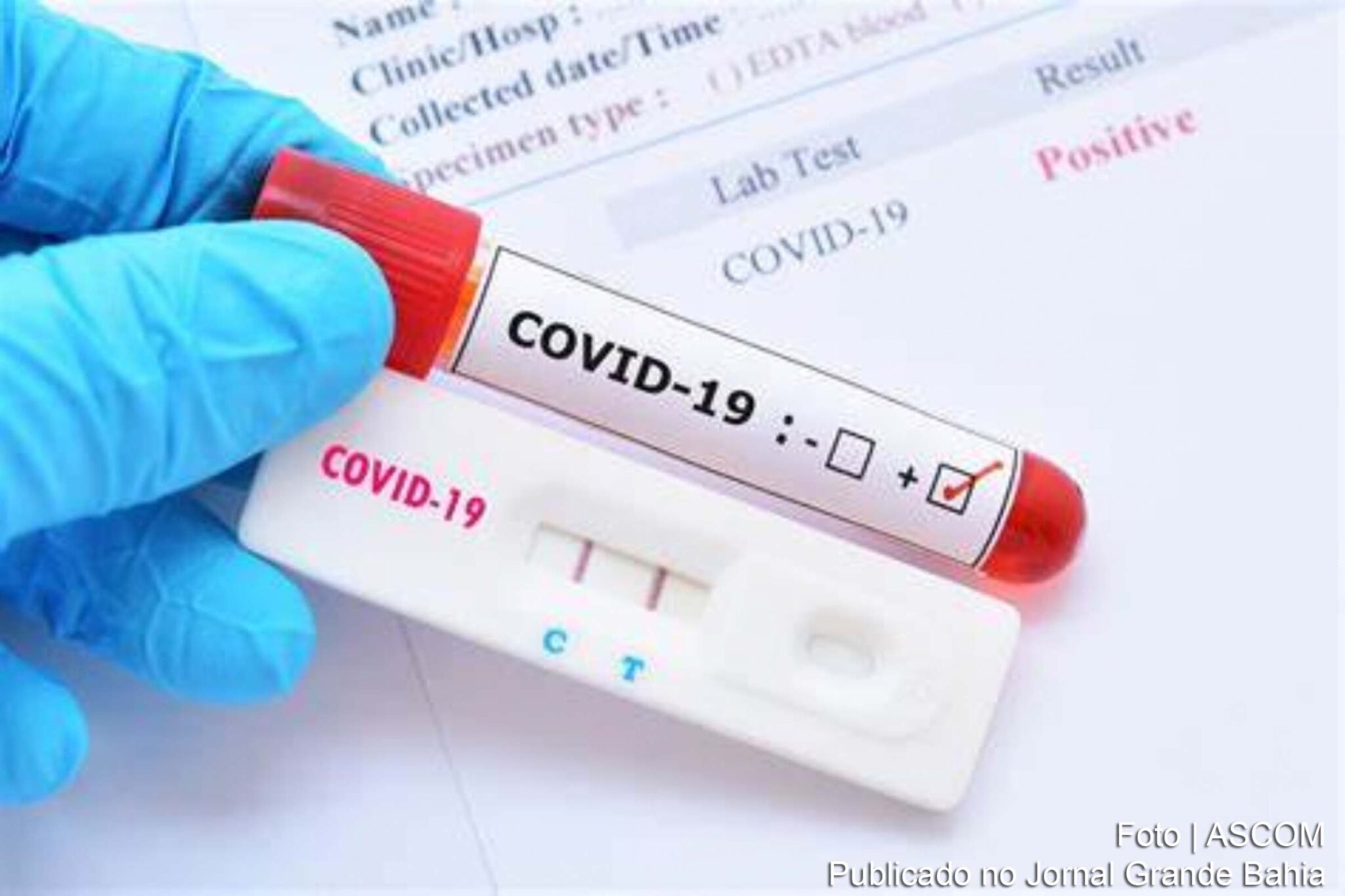 Feira de Santana registra redução no número de infectados pela Covid-19.