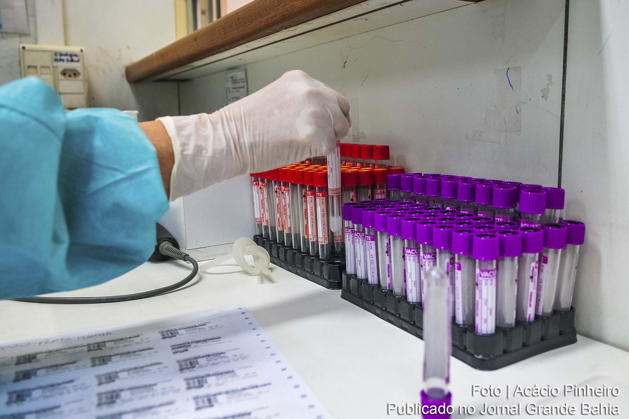 Pesquisa indica que pacientes curados da Covid-19 apresentam efeitos colaterais.