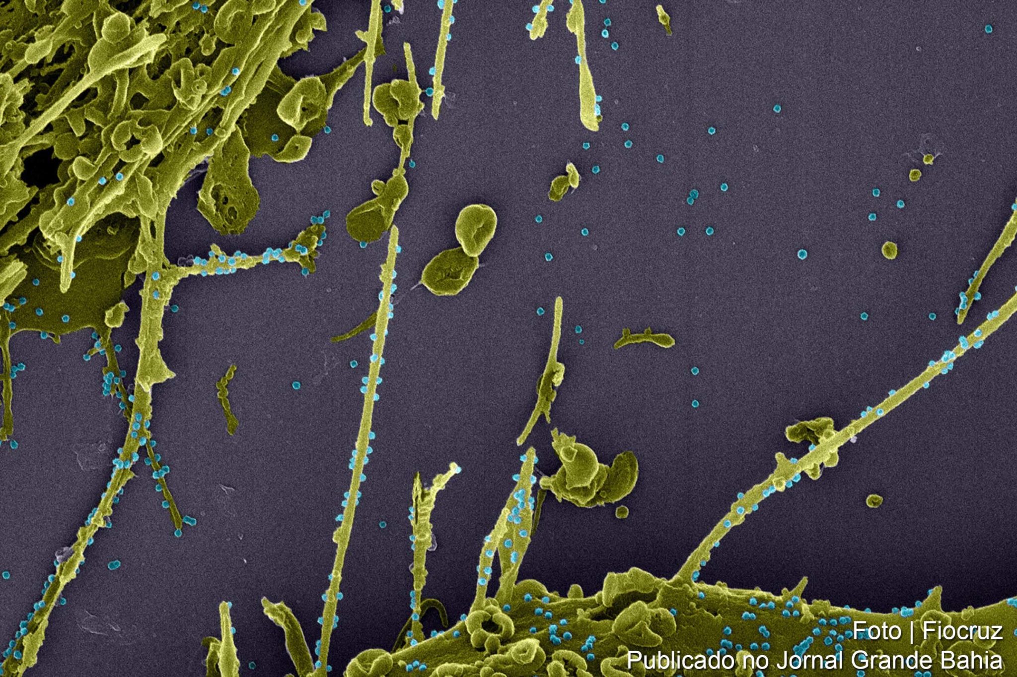 Coronavírus tipo SARS-CoV-2 apresenta mutação.