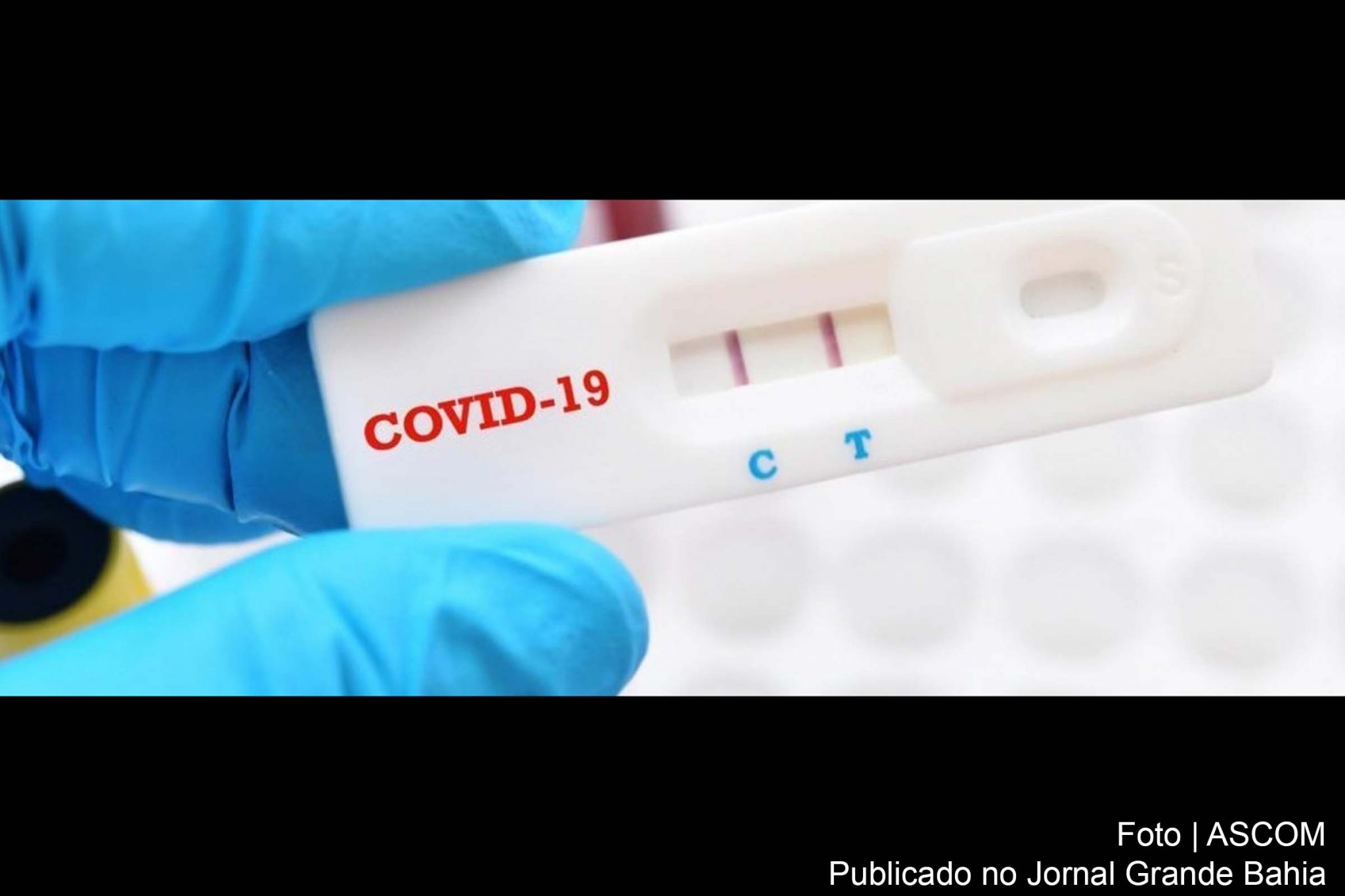 155 novos casos da Covid-19 foram registrados em Feira de Santana.
