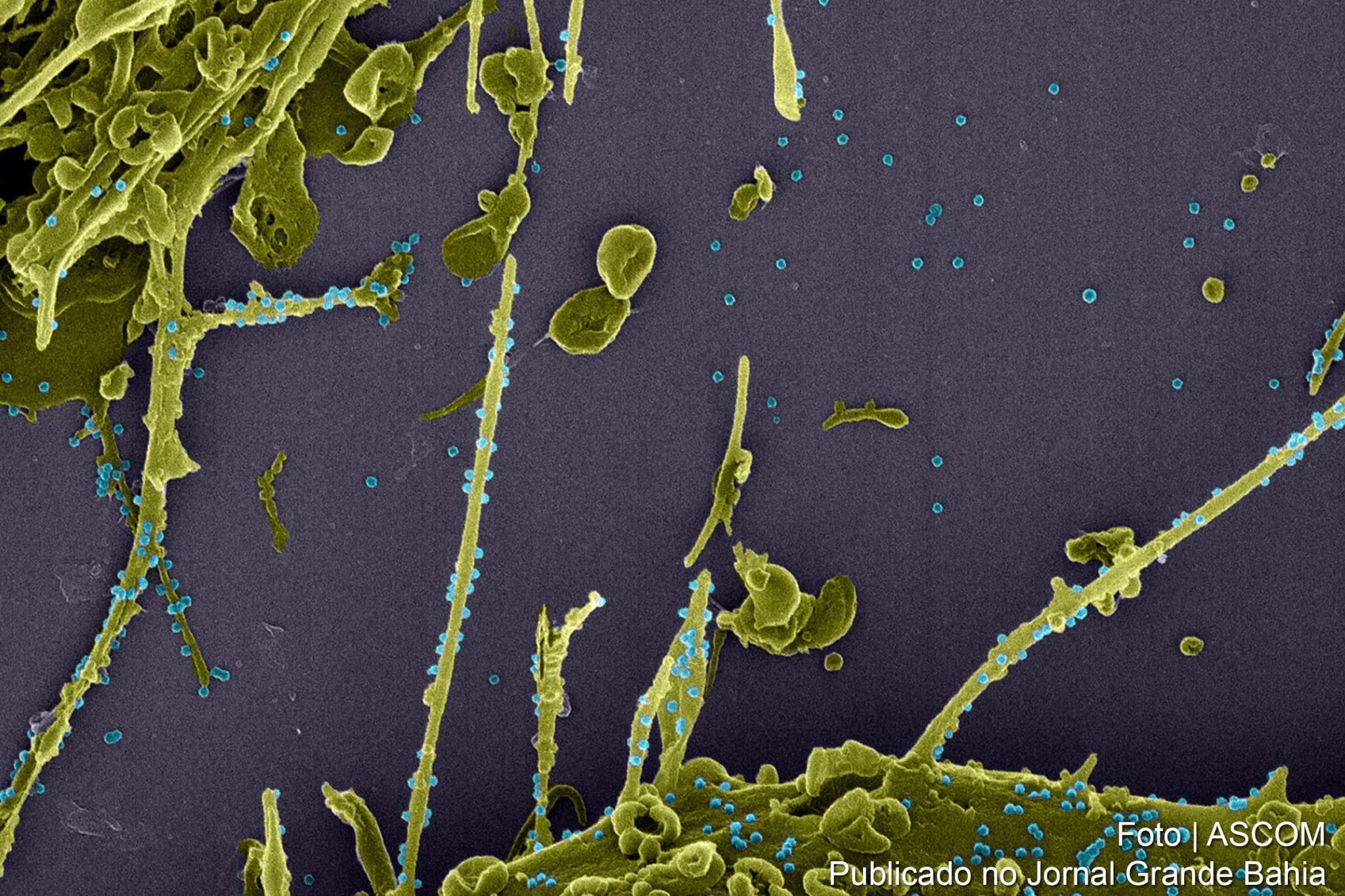 Amostra de coronavírus tipo SARS-CoV-2.