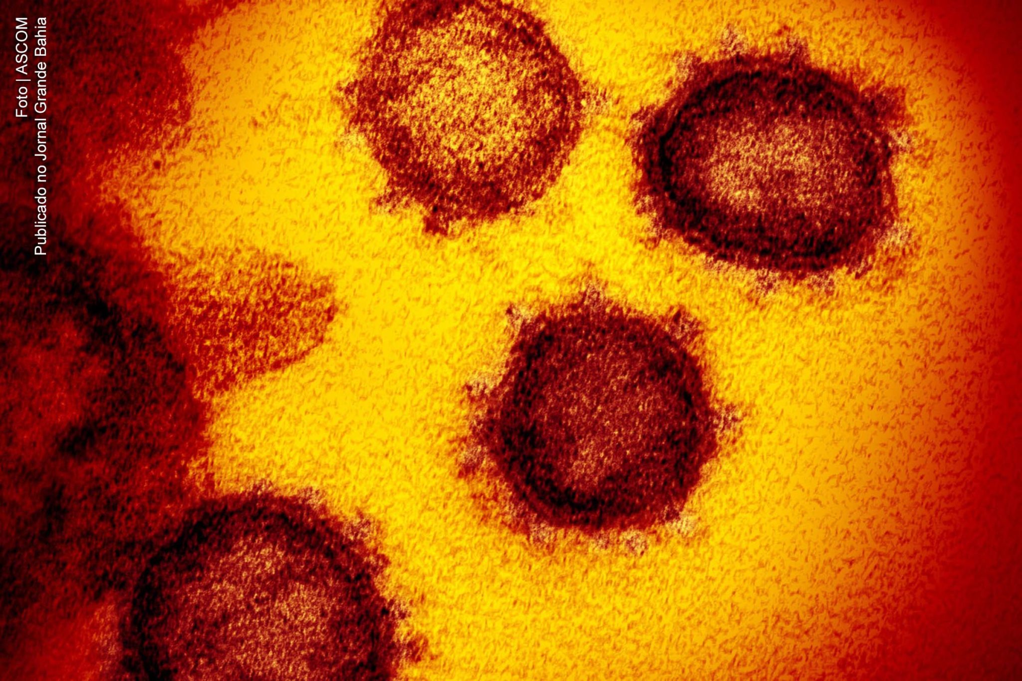 Imagem do microscópio eletrônico de transmissão mostra o SARS-CoV-2, também, conhecido como 2019-nCoV, o vírus que causa a Covid-19.