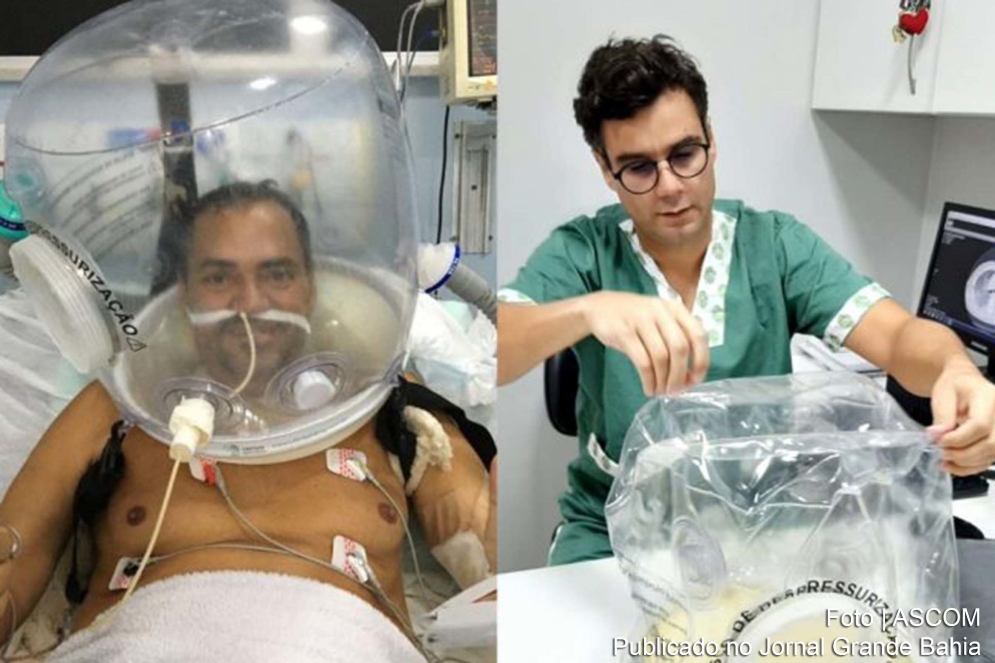 Em alguns casos, capacetes para ventilação podem ser utilizados em pacientes coma a Covid-19.