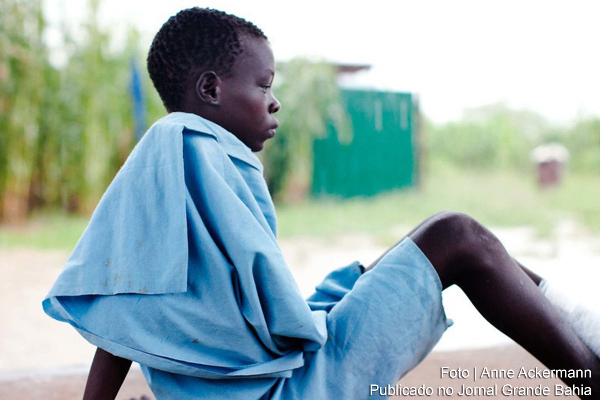 Menino no Sudão do Sul acaba de receber tratamento para dracunliasis.