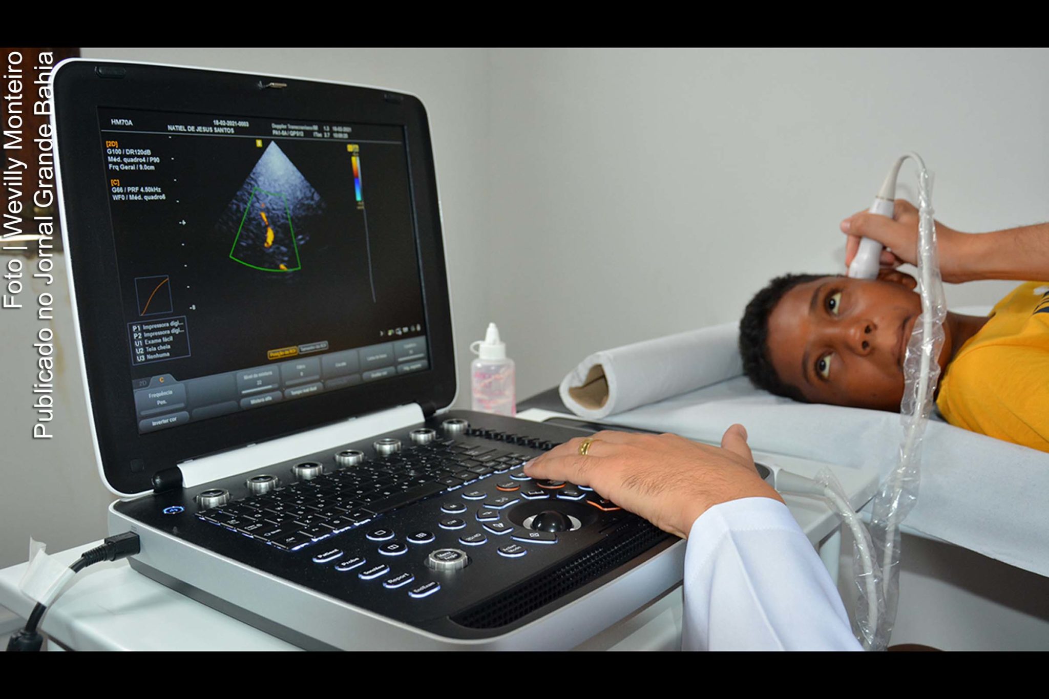 Através do Doppler Transcraniano é possível avaliar a velocidade do fluxo sanguíneo nas principais artérias cerebrais, e reduzir de 40 para 10% as chances desses pacientes desenvolverem a doença neurológica.