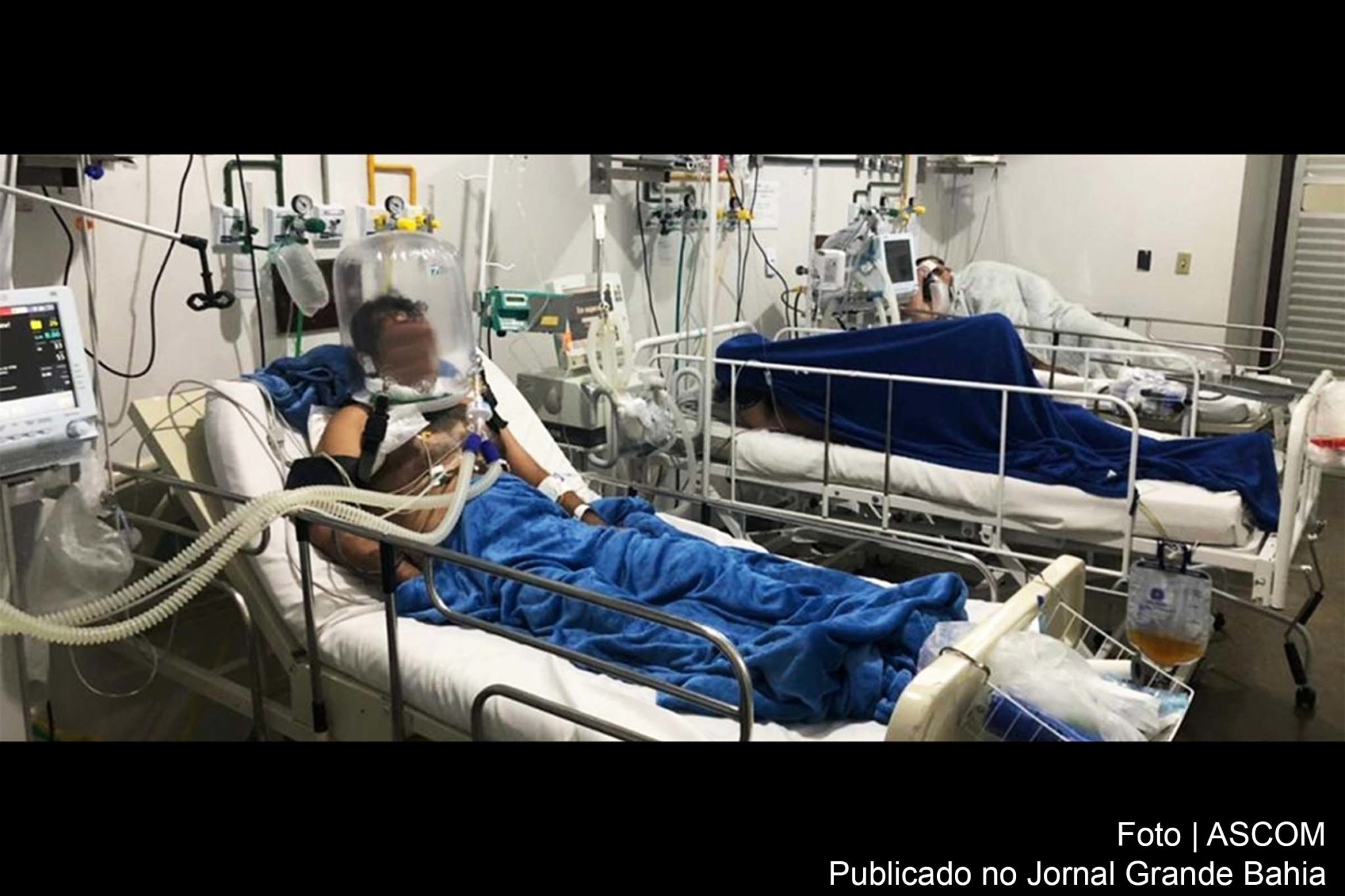 As vítimas com comorbidades representam 396 das 512 mortes por Covid-19, em Feira de Santana.