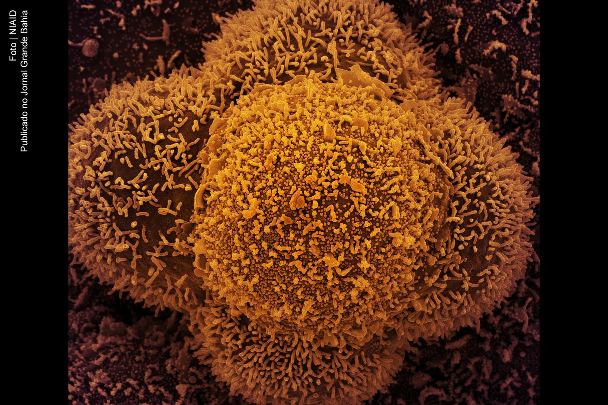 Variantes mais letais e com maior capacidade de infecção do coronavírus SARS-CoV-2 circulam no Brasil, aumento incidência de contaminados e mortes.