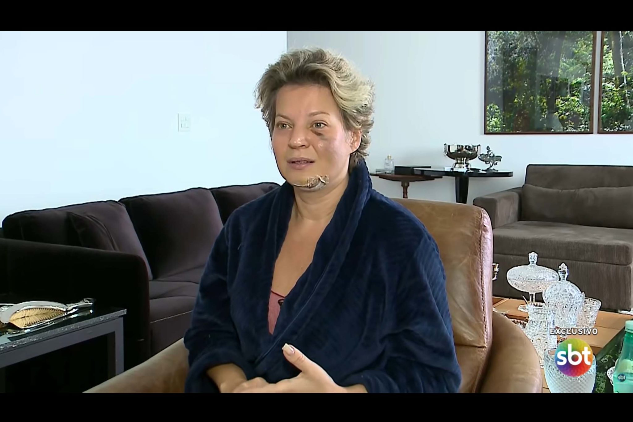 A Polícia Legislativa da Câmara dos Deputados concluiu, nesta terça-feira (27/07/2021), que "não houve quebra de segurança" no apartamento da deputada Joice Hasselmann (PSL-SP), em Brasília. A parlamentar alega que, no dia 18, acordou em meio a uma poça de sangue no chão do closet e não se lembrar do que aconteceu. Embora diga que não se lembra do que aconteceu, afirma acreditar que foi “vítima de um atentado”.