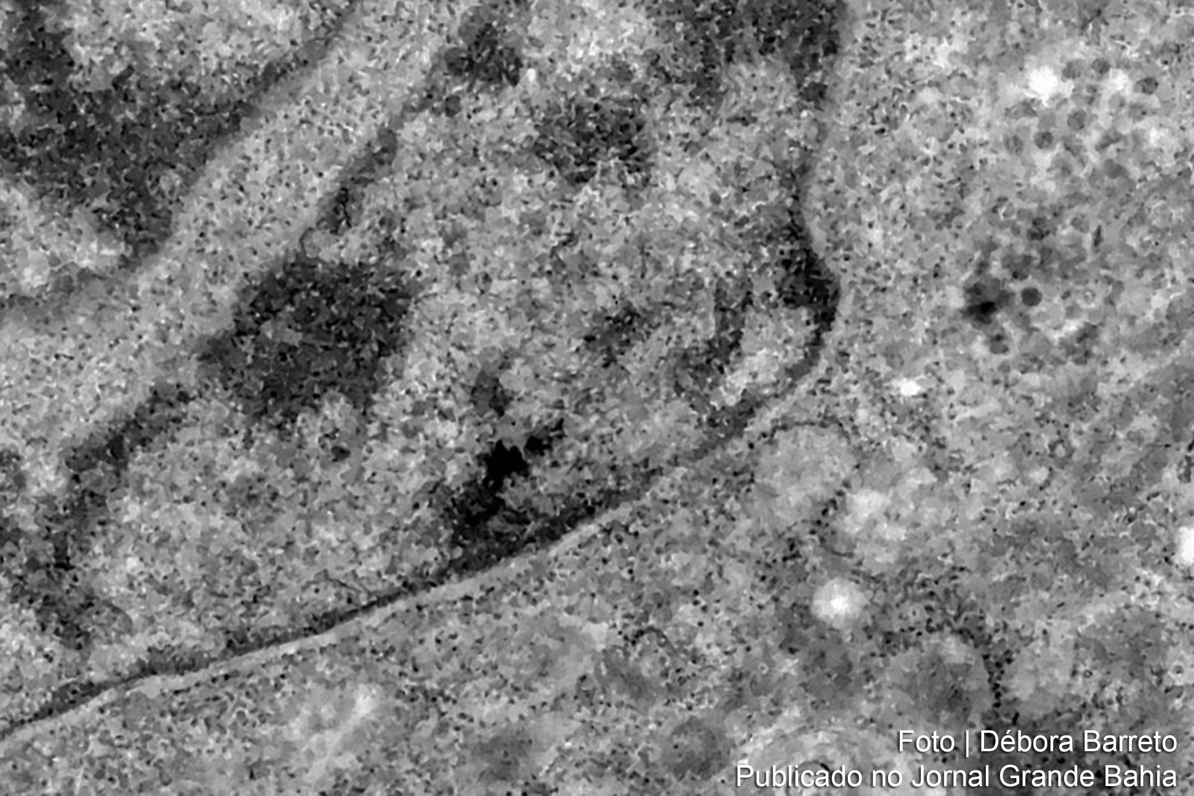 O estudo pode contribuir para compreender melhor a dinâmica do vírus e as sequelas em pacientes infectados.
