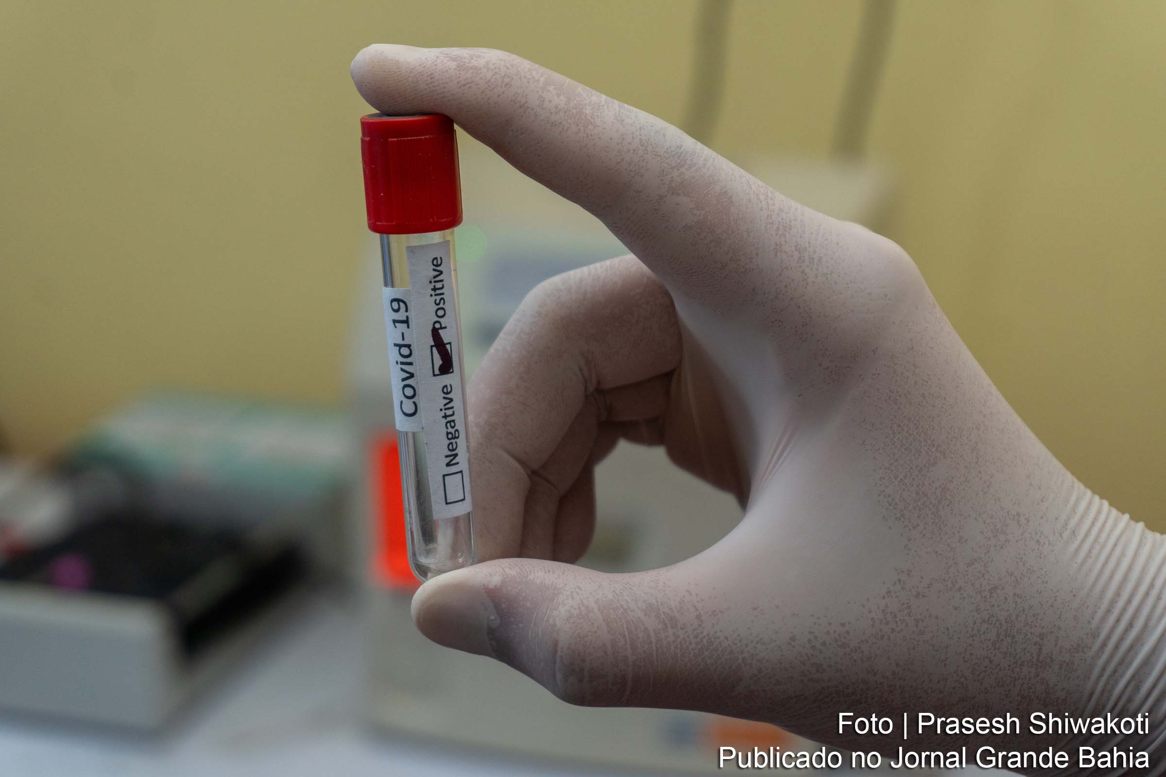 Boletim epidemiológico contabiliza ainda 11 pacientes internados em Feira de Santana.