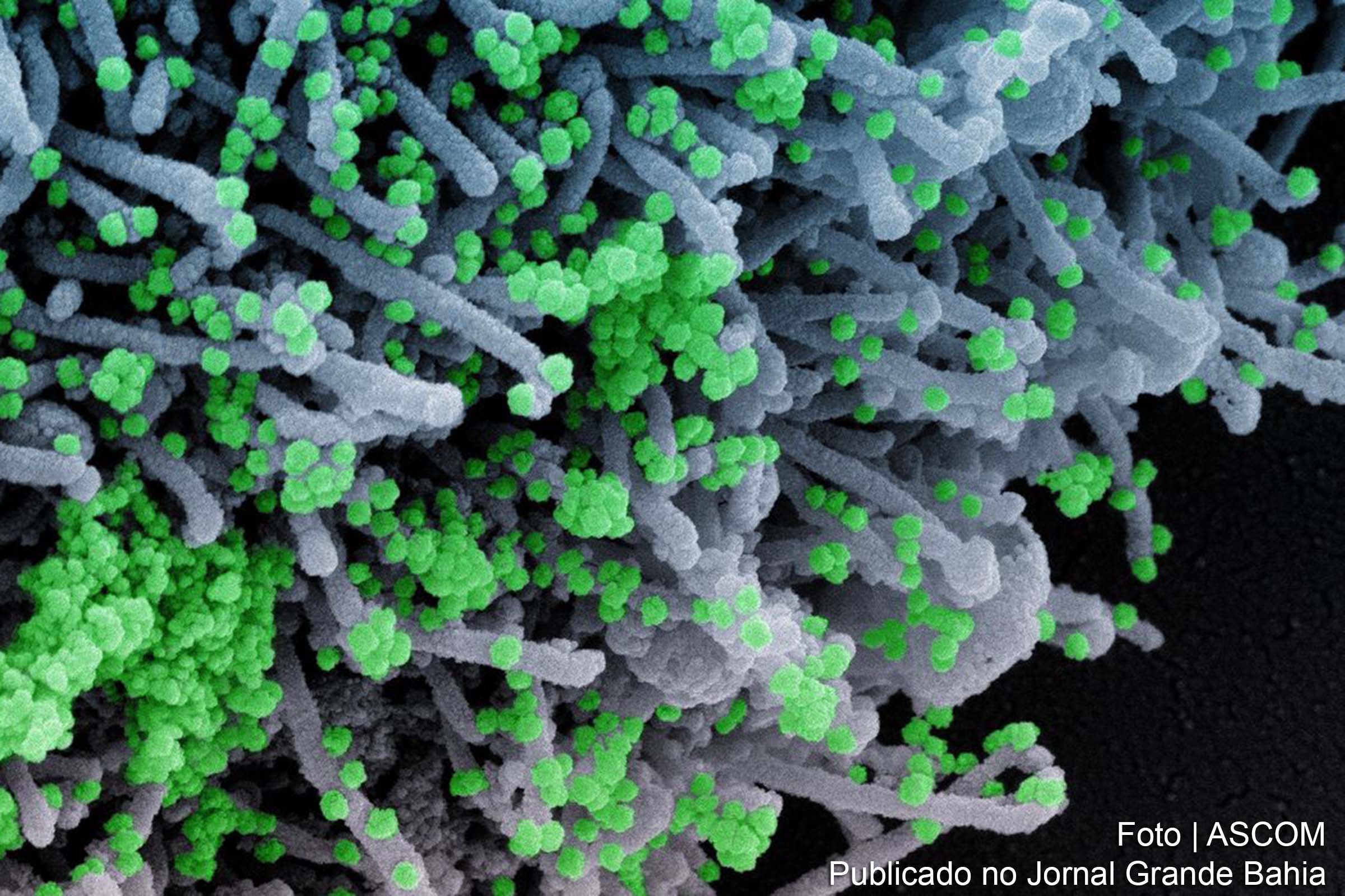 Reino Unido torna-se o primeiro país a liberar um tratamento que tem o potencial de mudar o curso da pandemia.