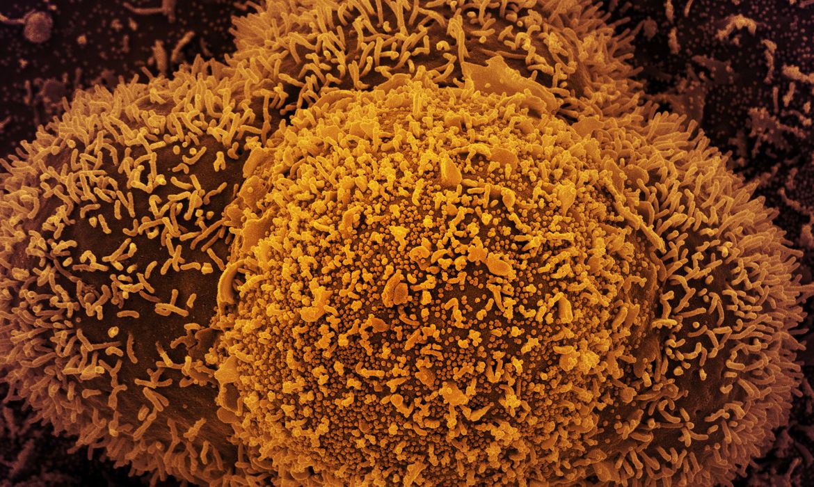 Estudo também informa que a taxa de ocupação de leitos de UTI pela doença no SUS segue em queda ou em estabilidade em quase todo o país.