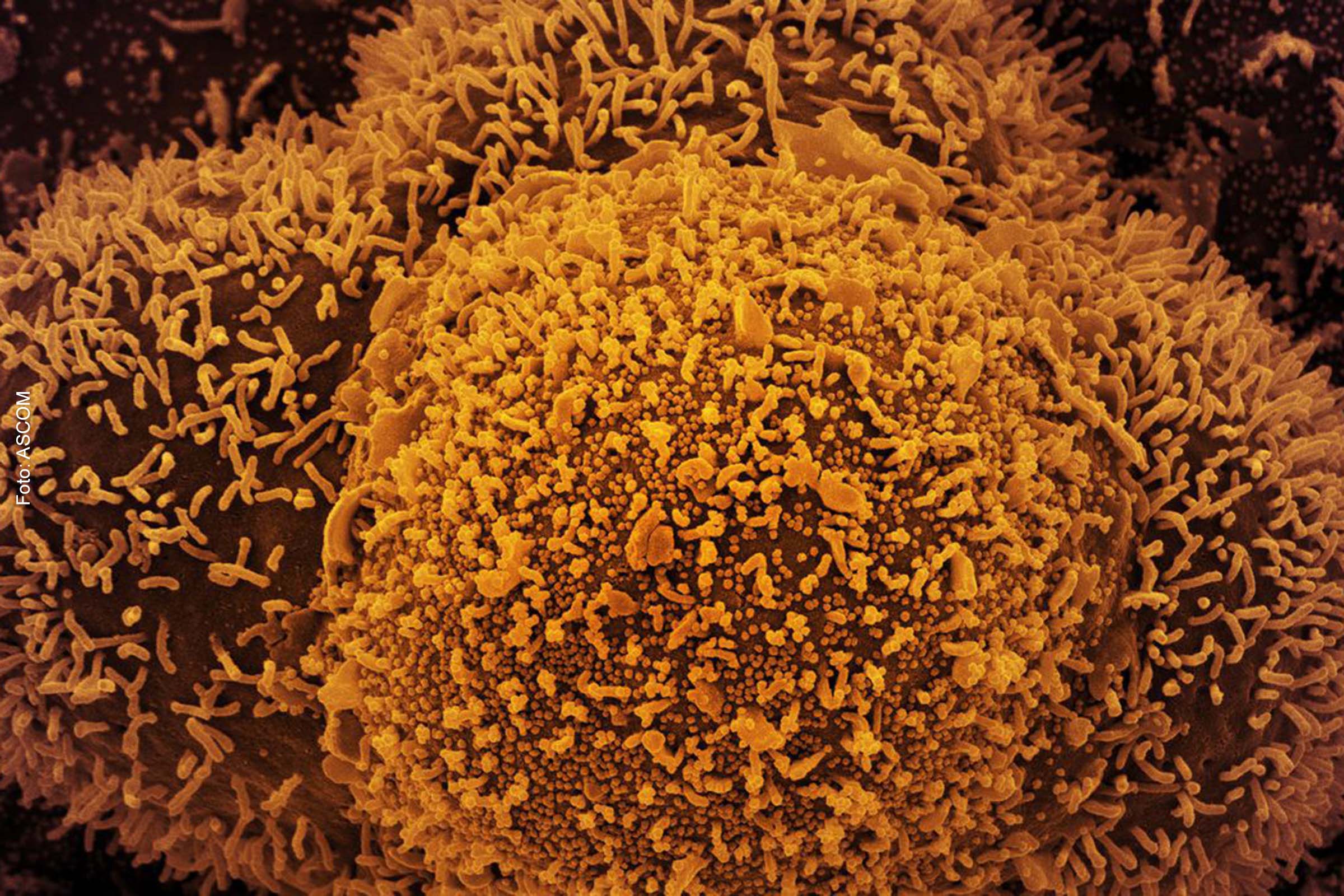 Infecções globais do novo coronavírus atingiram uma alta recorde no último período de sete dias.