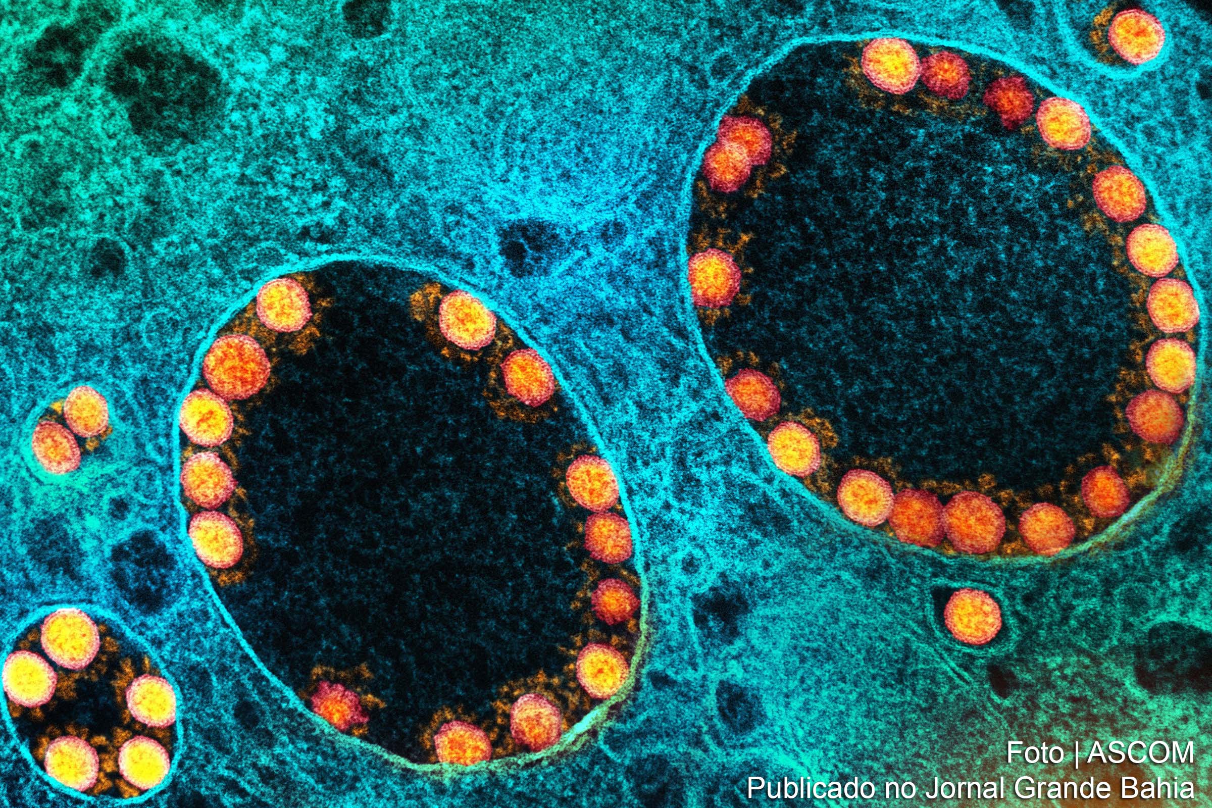 Imagem da variante Ômicron do SARS-CoV-2.