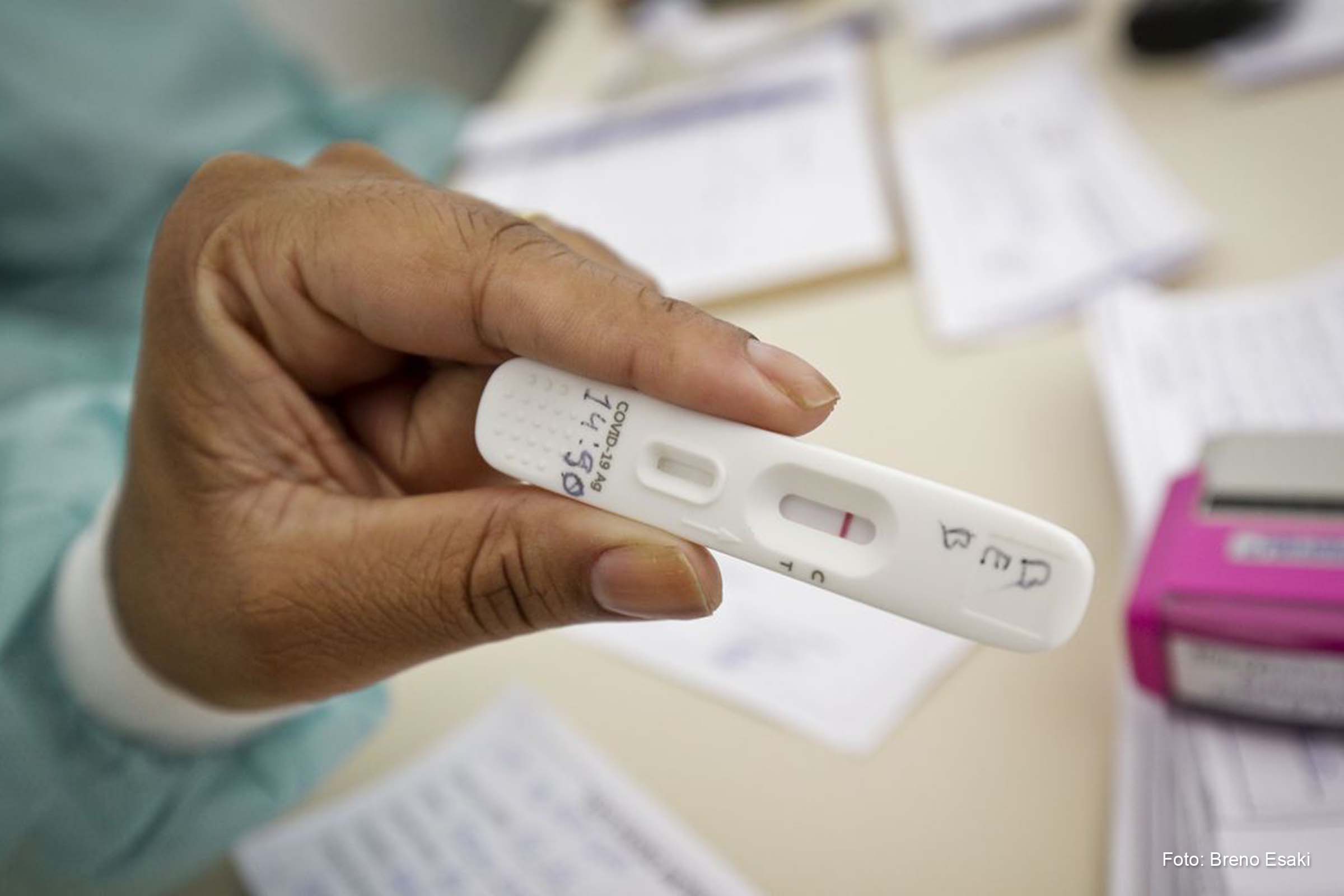 SENACON notifica empresas sobre alta de preços de testes de Covid-19