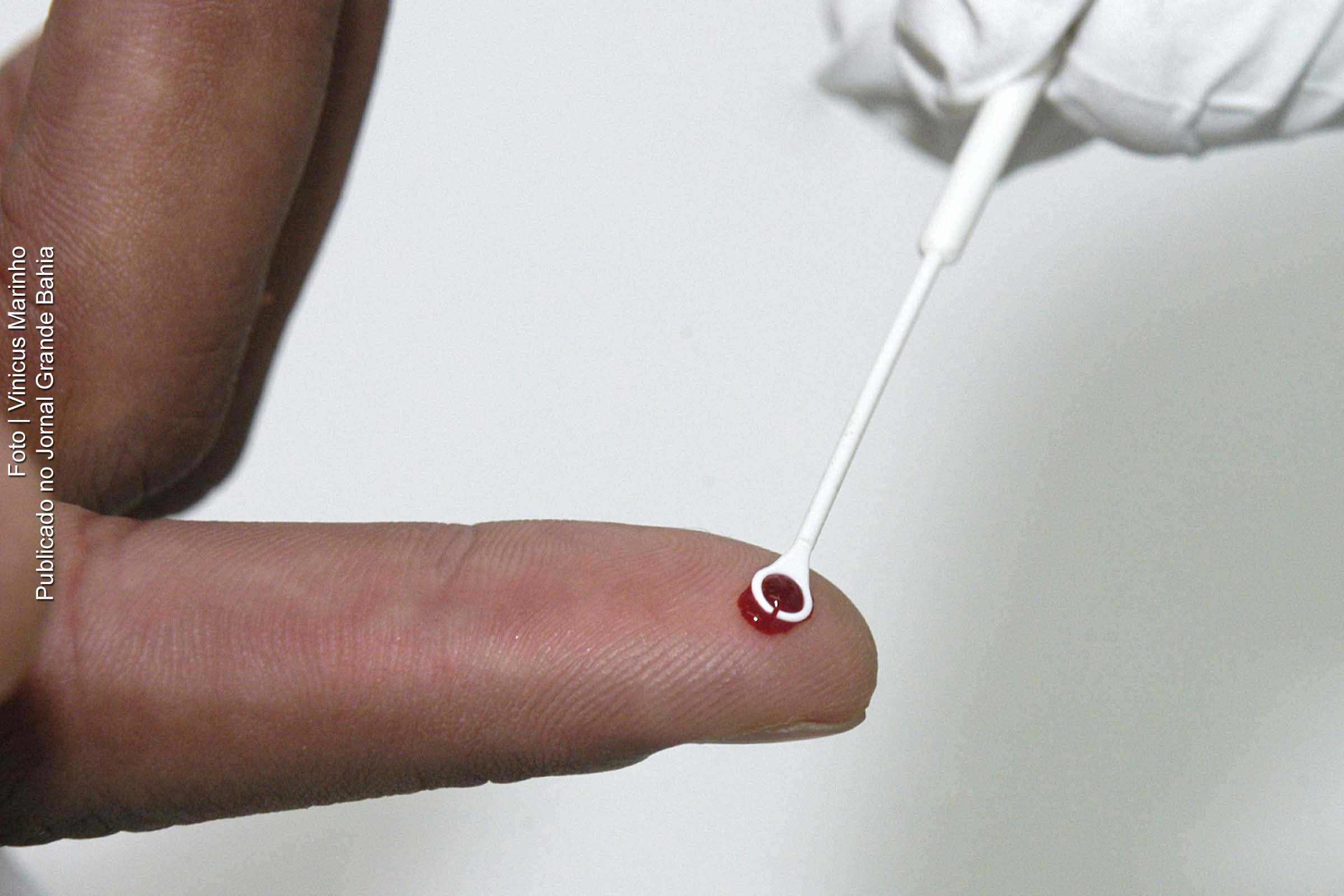 Coinfecção por HIV e HTLV na Bahia é investigada.