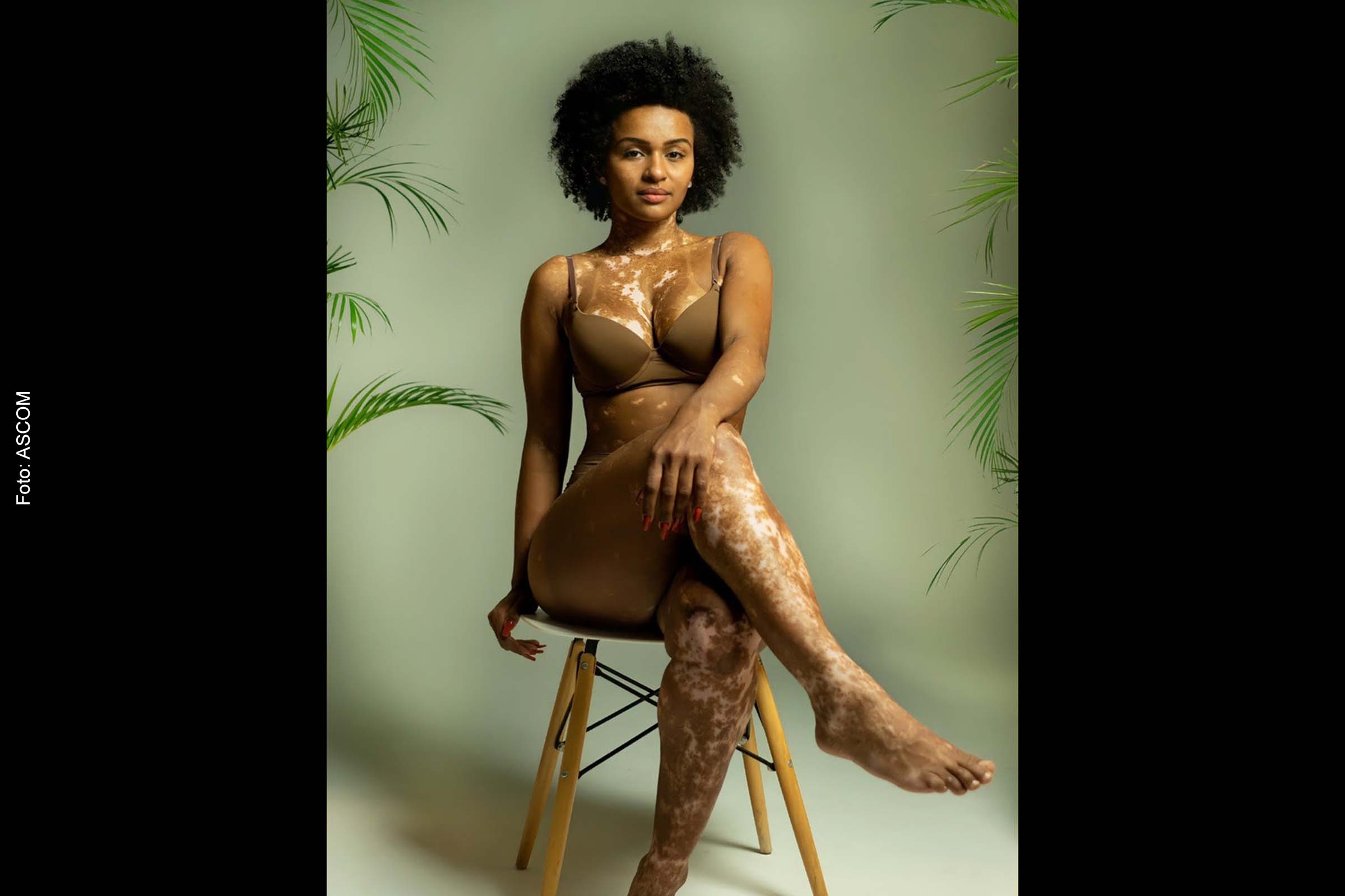 Natália Deodato, participante do BBB 2022, que é portadora de vitiligo.