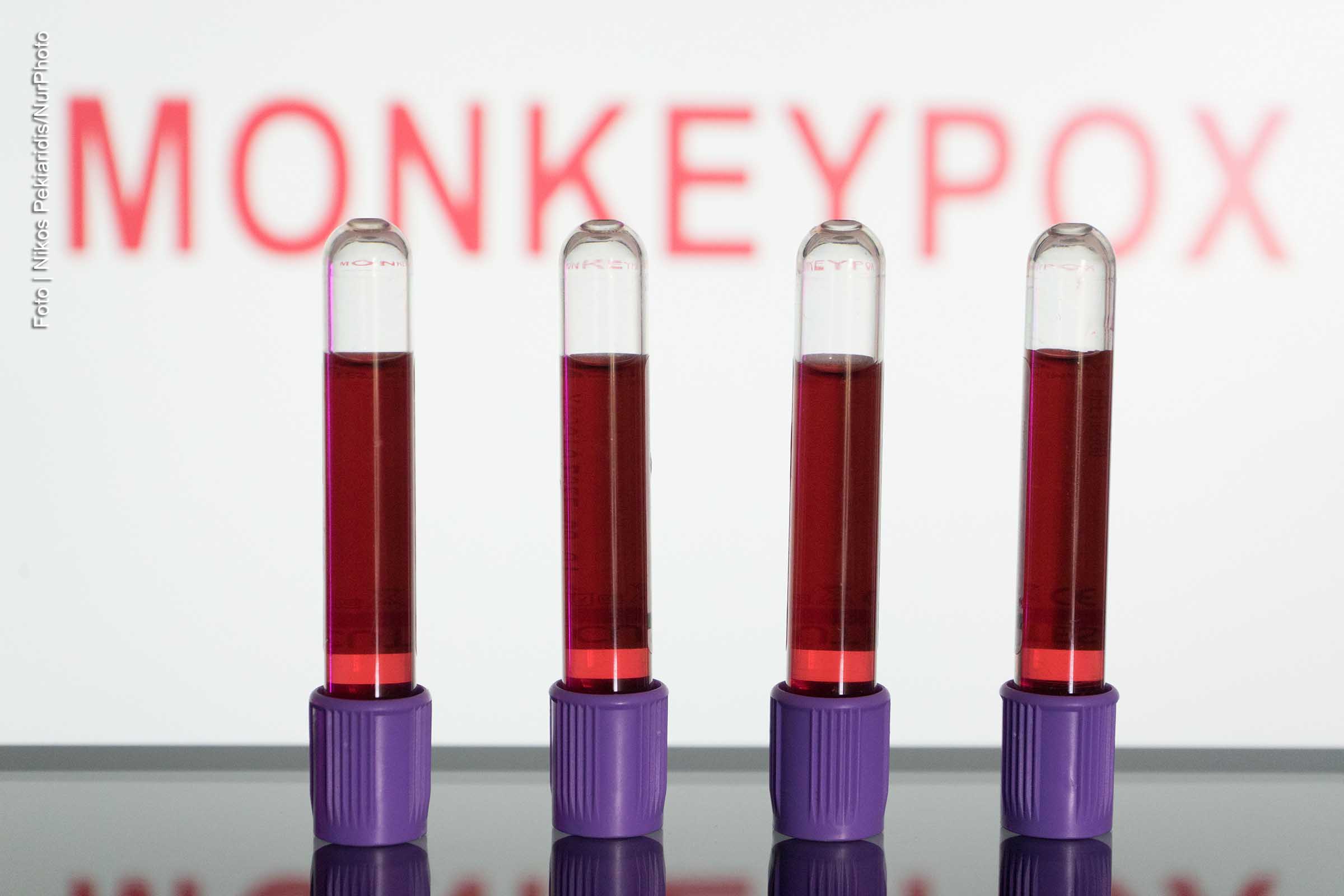 Um surto em andamento da doença varíola dos macacos foi confirmado em maio de 2022, começando com um conjunto de casos encontrados no Reino Unido.