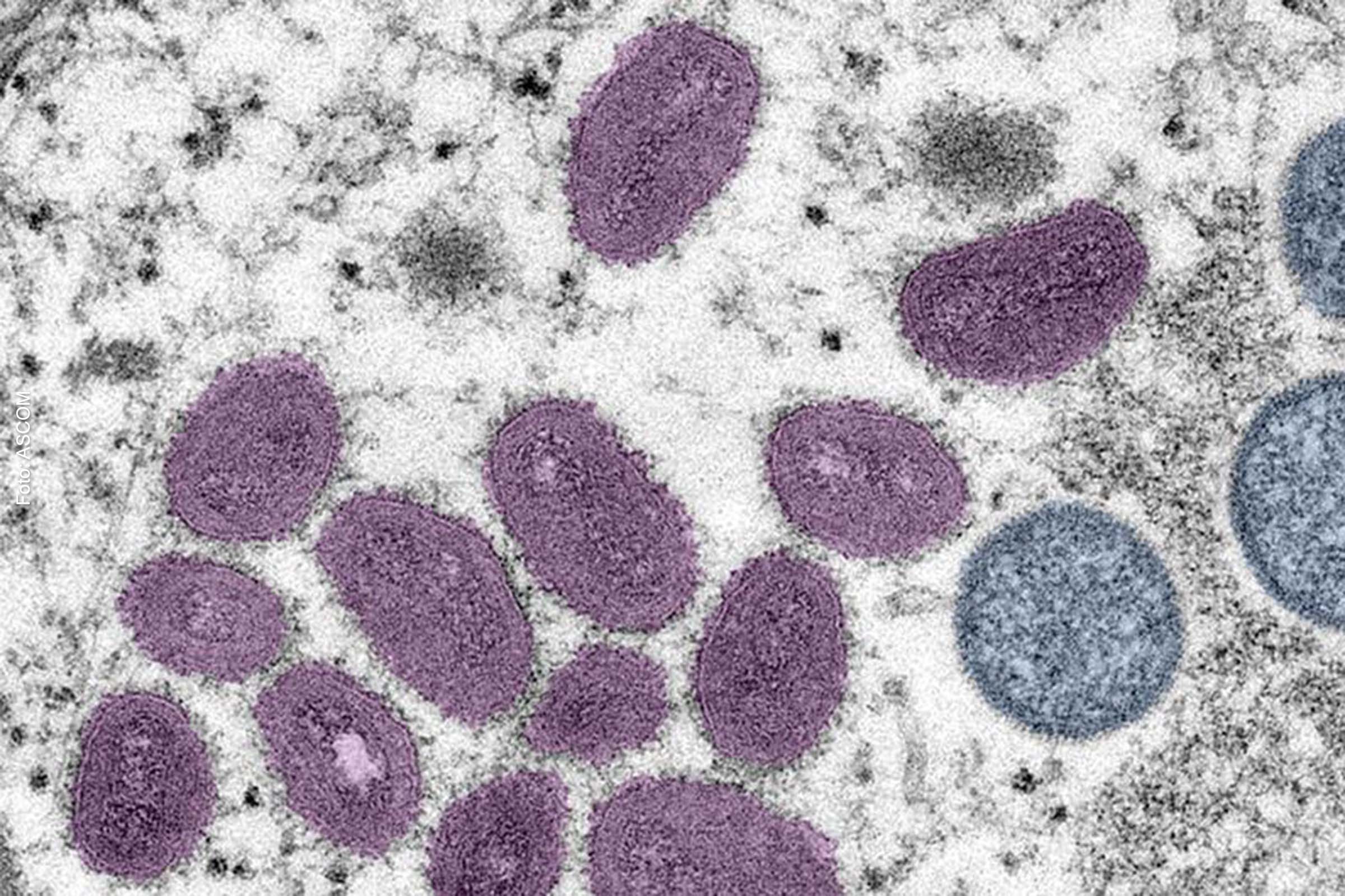 Entre 98 países com notificações, Brasil aparece com 3.450 infecções confirmadas e Portugal, com 810.