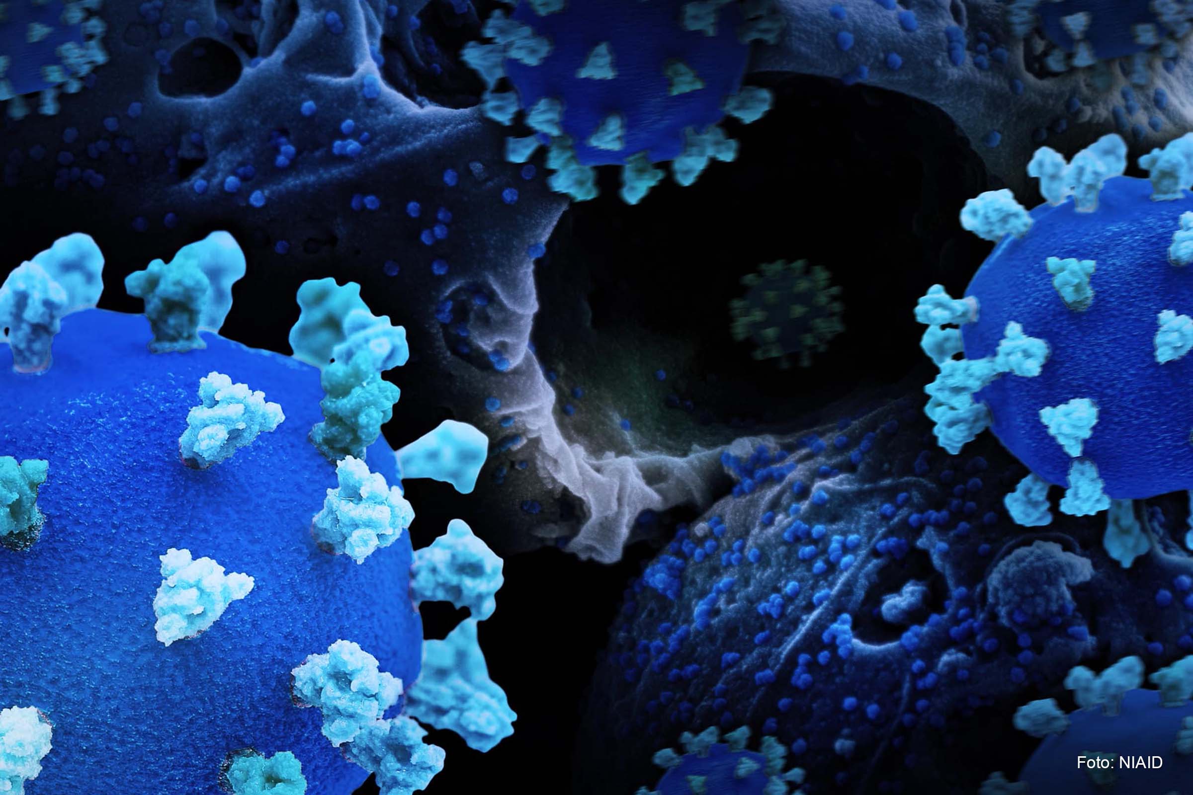 Após 6 meses da infecção por COVID, 60% das pessoas ainda têm alguns sintomas e após 1 ano metade das pessoas ainda relatam a persistência dos sintomas.