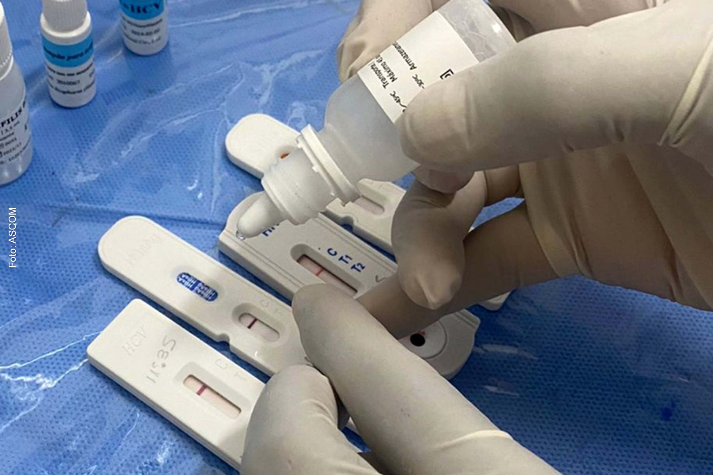 Em 2021, a ocorrência de novas infecções pelo HIV em mulheres entre 15 e 34 anos – idade reprodutiva- representou 45,6% dos casos.