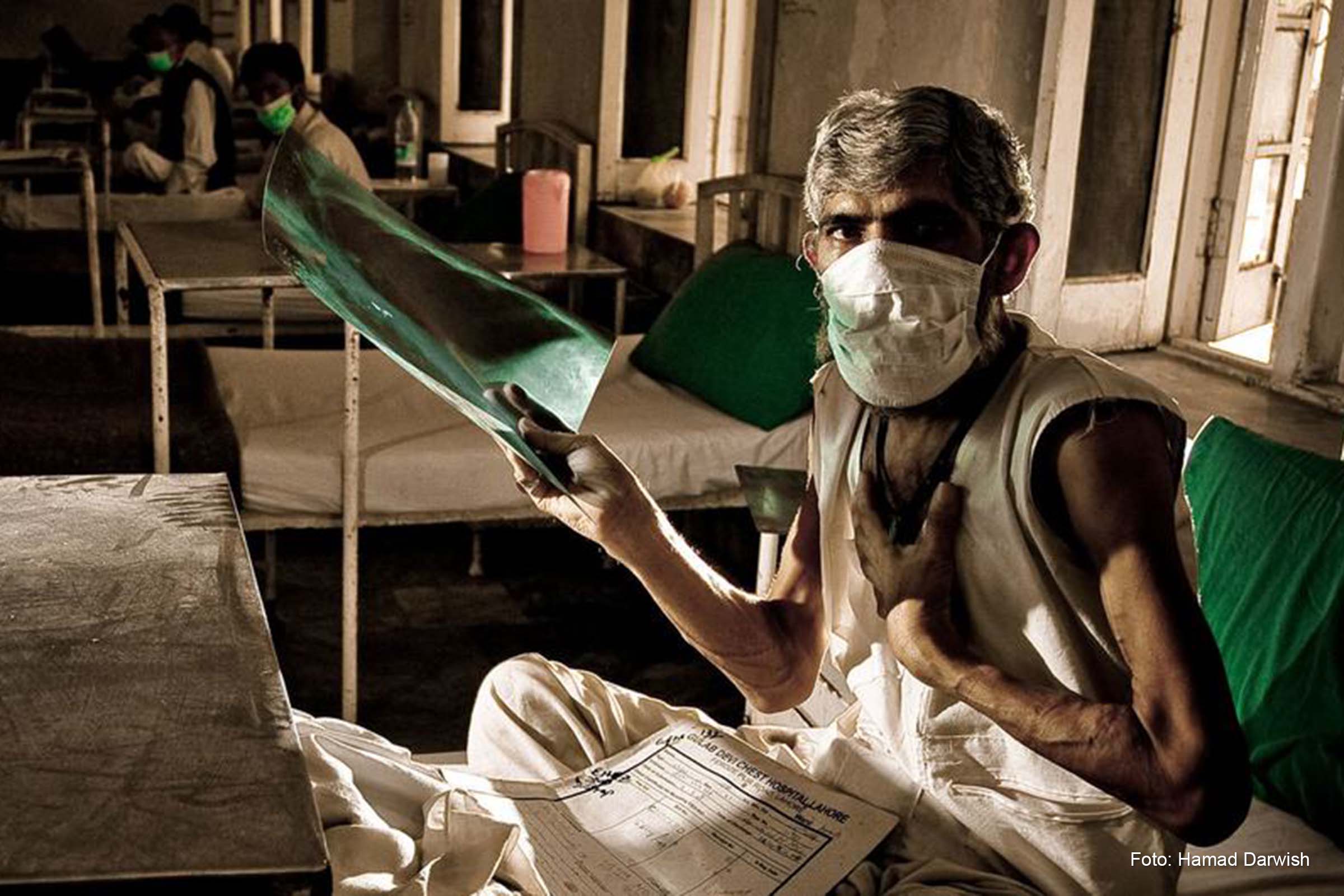 Angola, Brasil e Moçambique estão na lista dos países de alta carga.