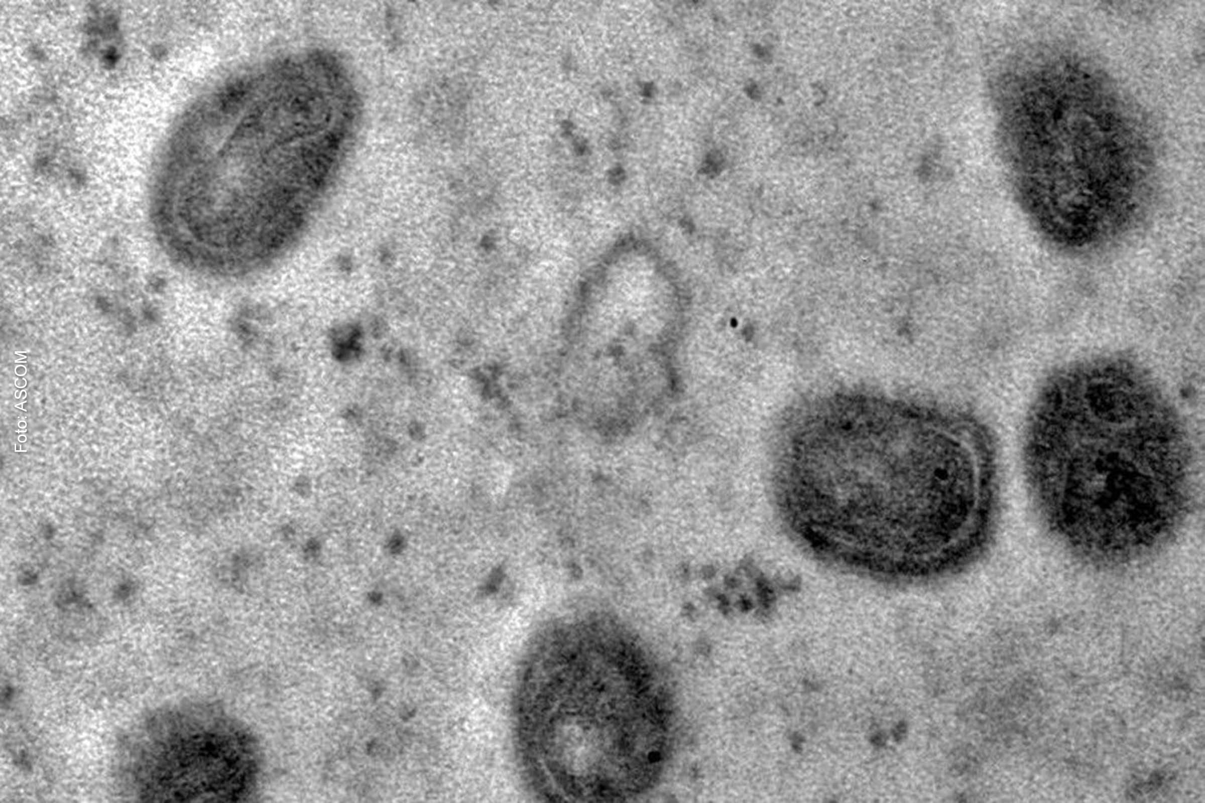 Em julho de 2022, a entidade decretou o status de emergência em razão do surto da doença em diversos países.