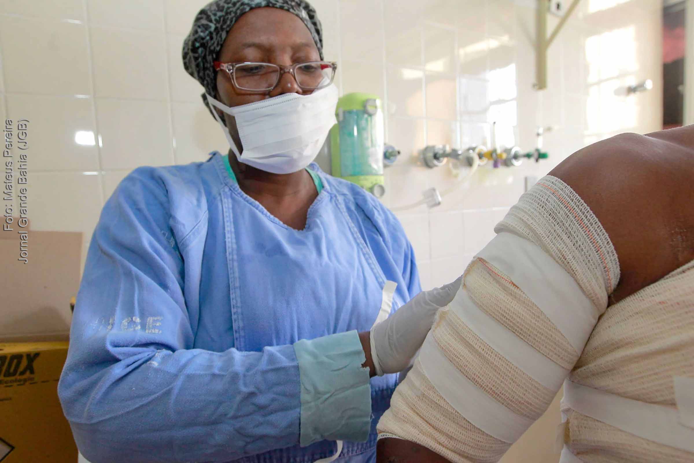 Bahia é referência no tratamento de queimados.