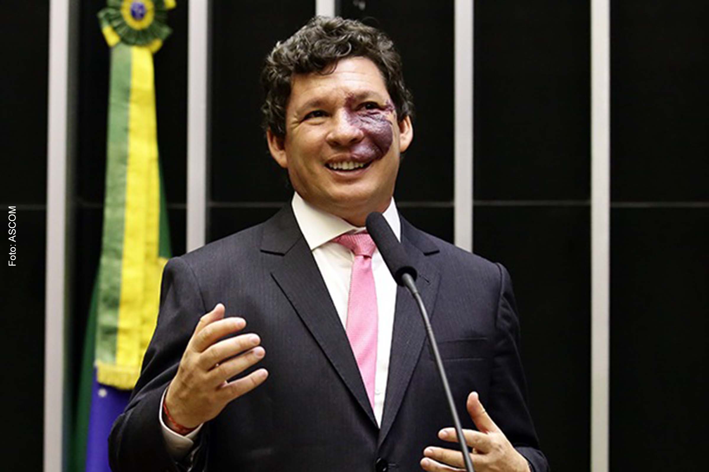 Deputado federal Reginaldo Lopes (PT-MG) disse que proposta de IVA Dual não encontra resistência e que, por isso, modelo será mais viável para gerar consenso em torno da reforma.