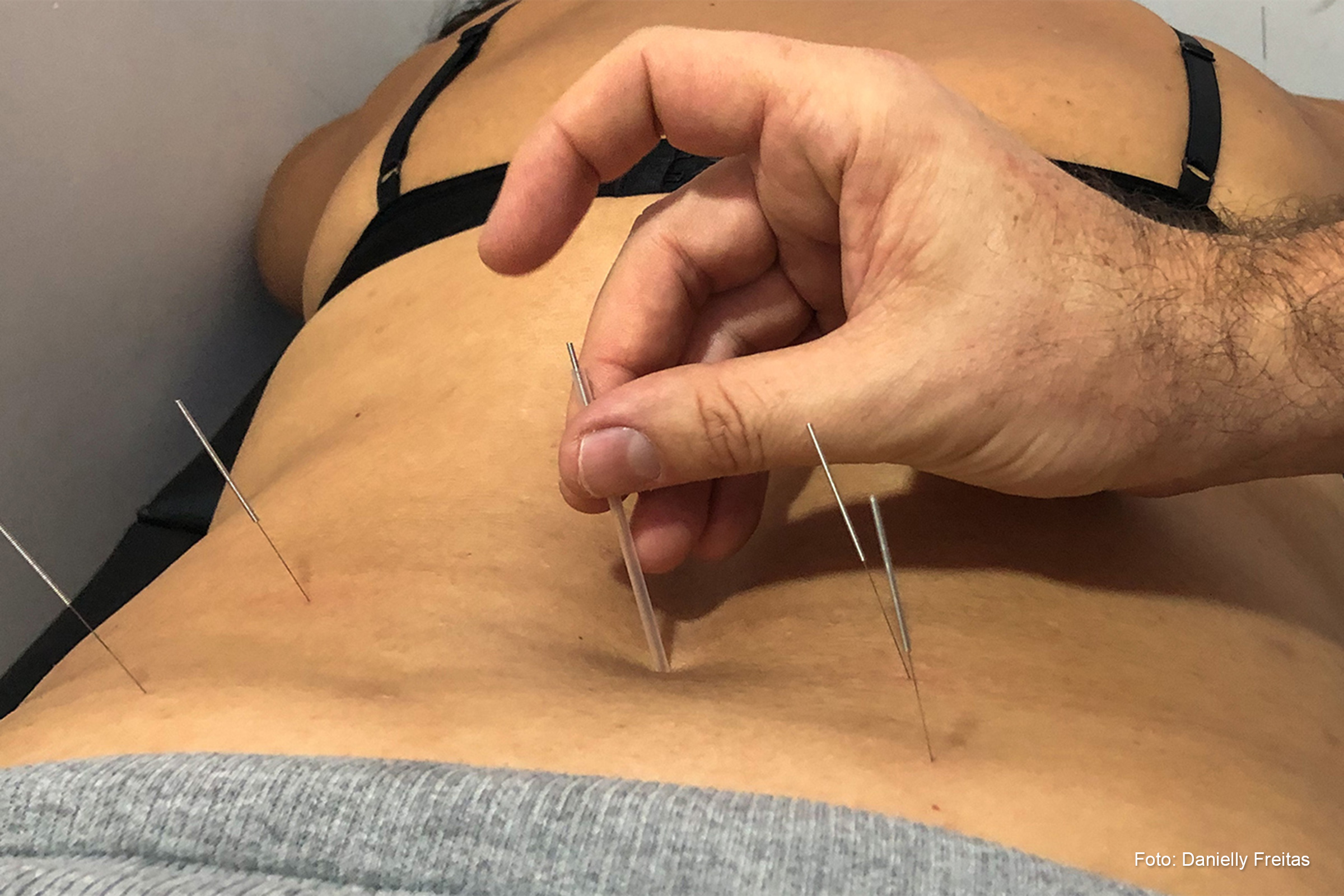 Serviço é destinado aos pacientes cadastrados na rede CAPS, que sofrem transtornos psicológicos e que possuem fibromialgia, artrite e outras doenças reumatológicas.